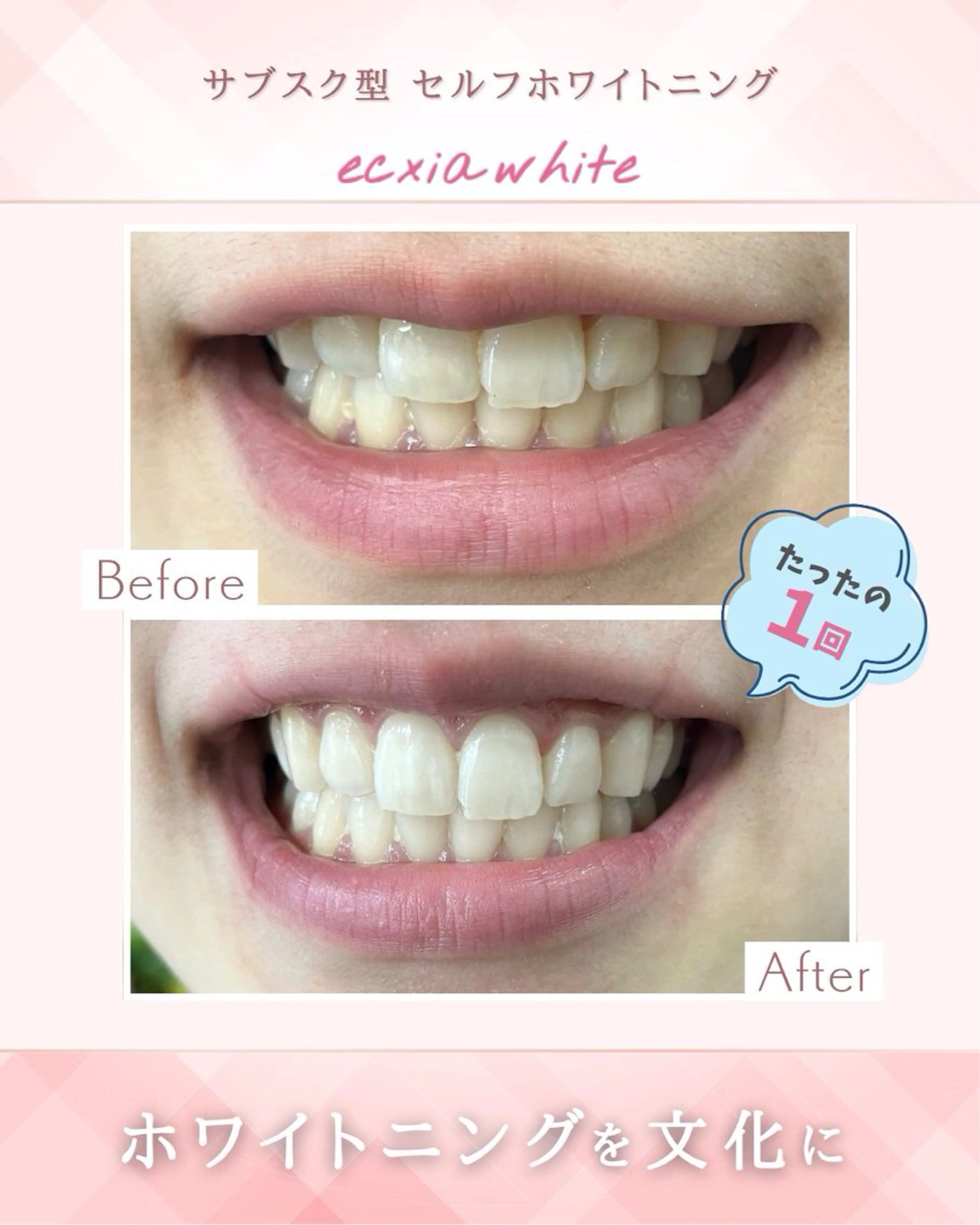 エクシア ホワイトニング西条店のその他イメージ