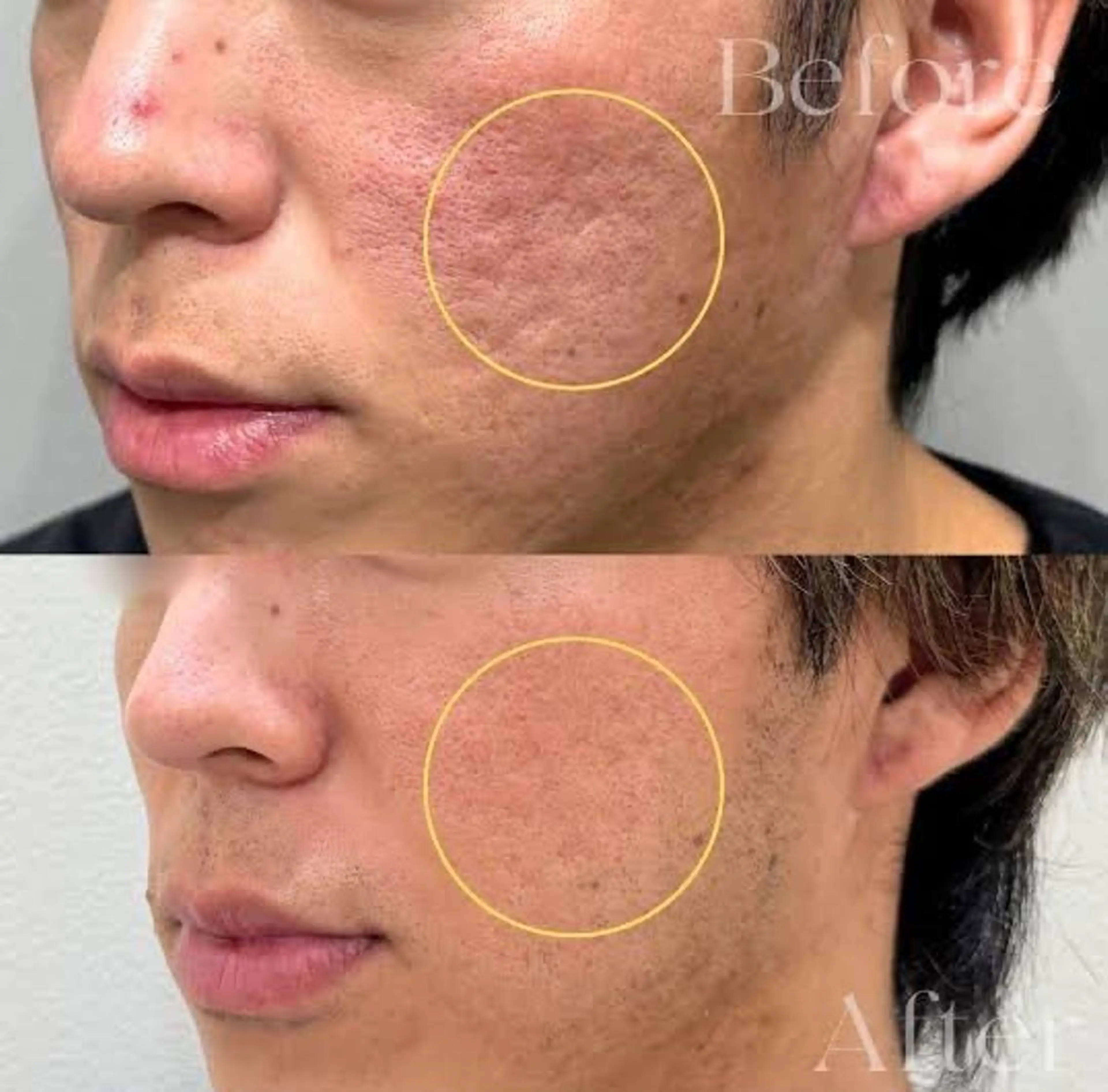 Luana武蔵小杉店 (ルアナ)の眉毛・アイブロウイメージ