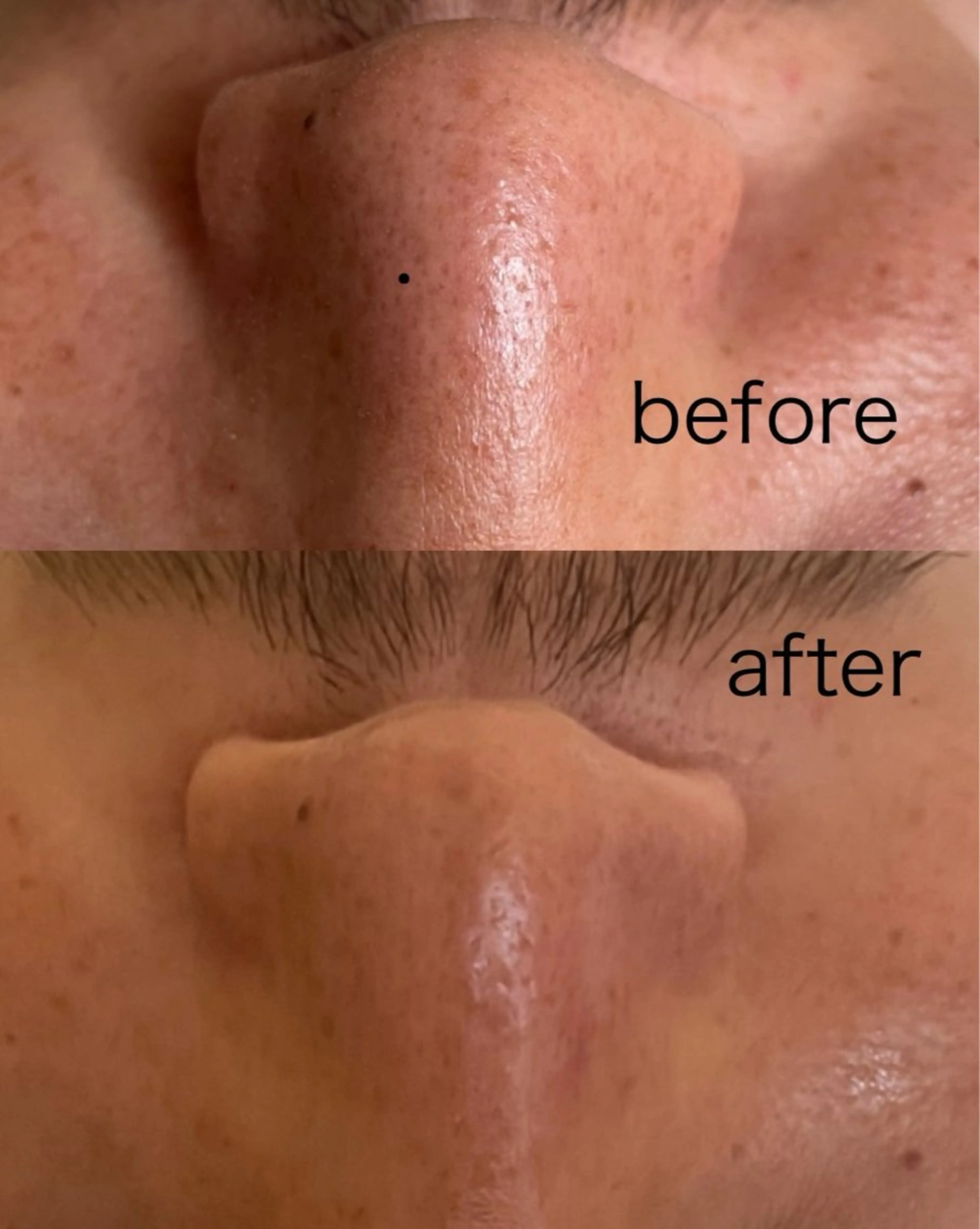 小顔 🌿R-isa森井のエステ・リラクイメージ