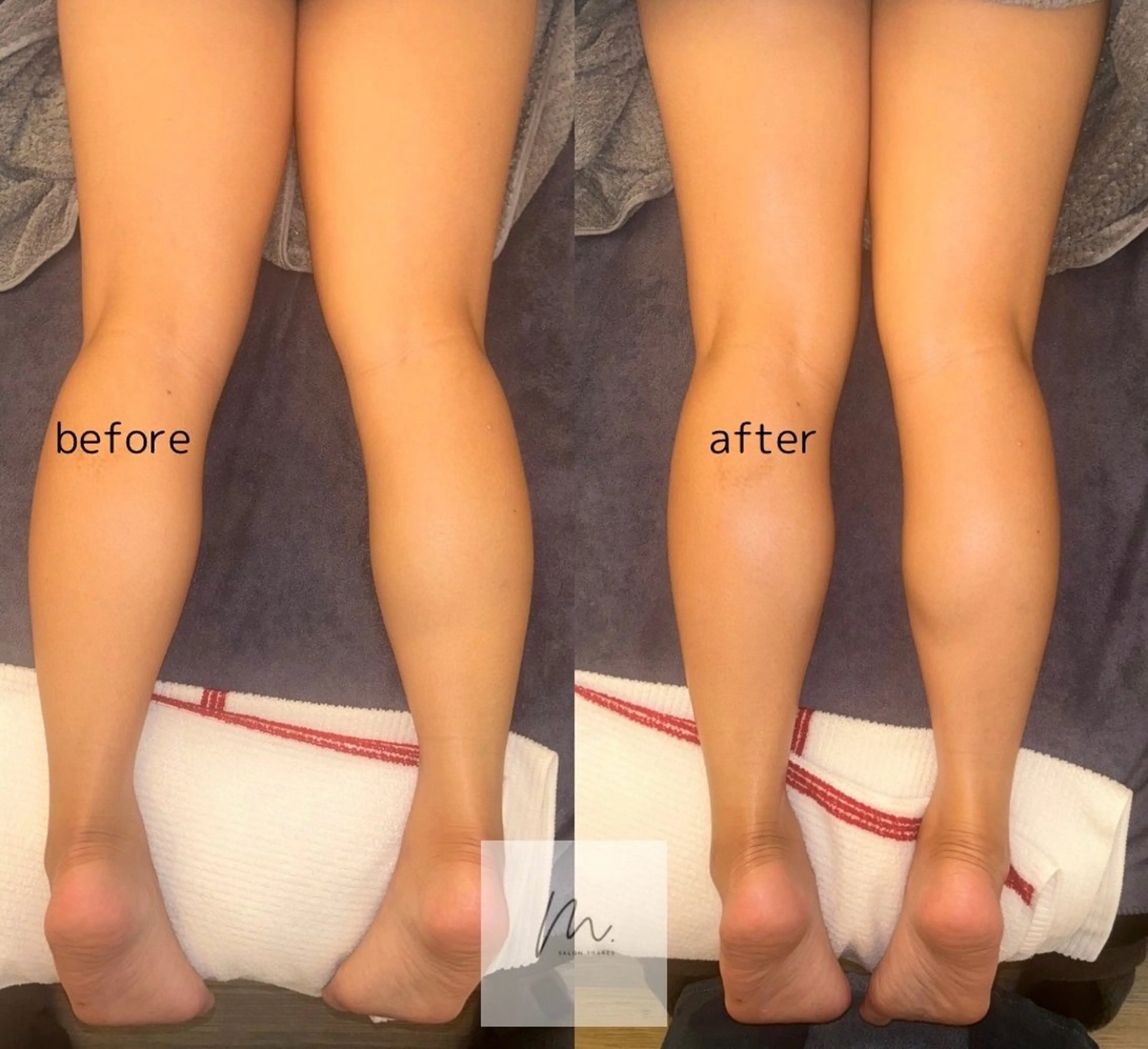 SHARES MADOKAのエステ・リラクイメージ