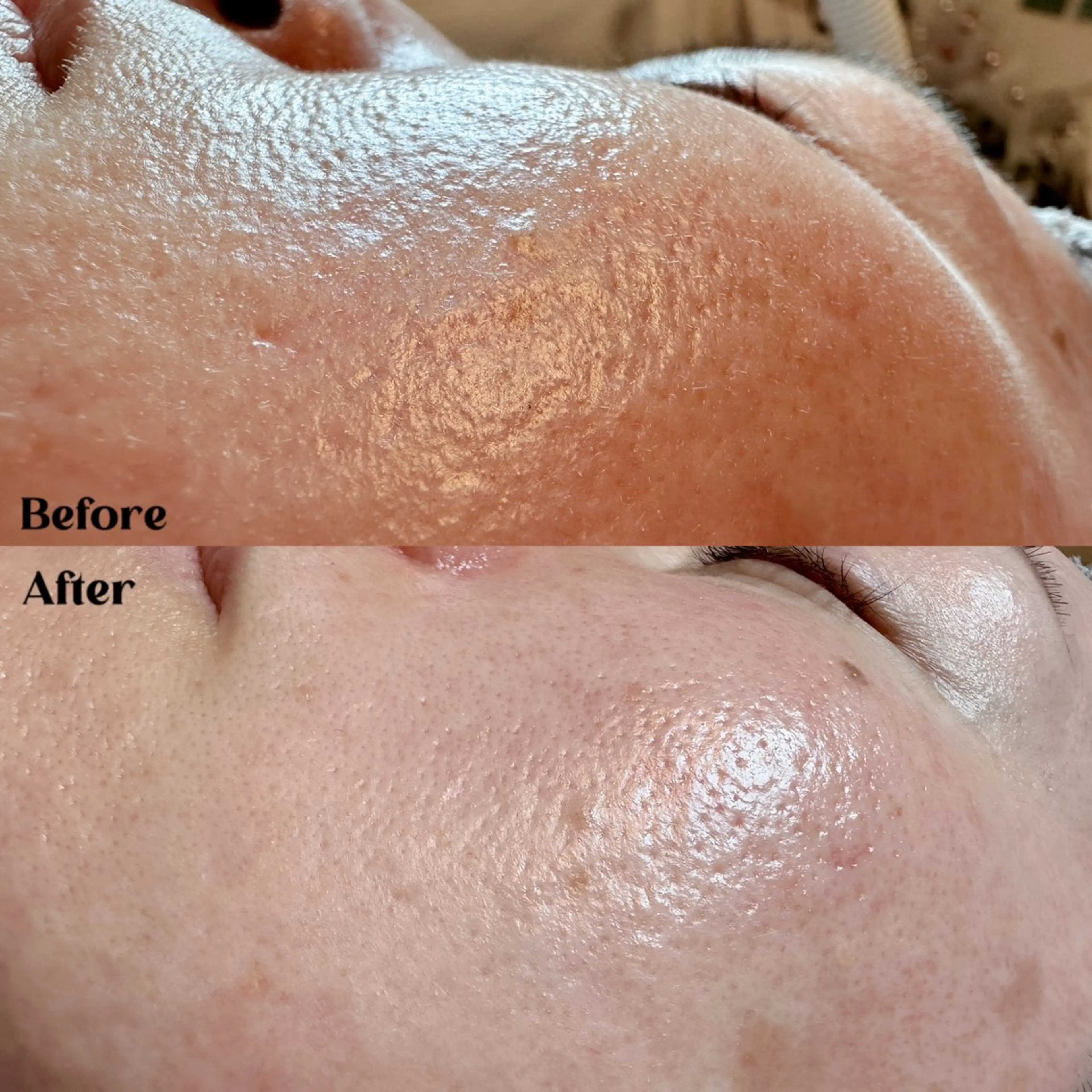 Hitomi シュガーリング豊橋のその他イメージ