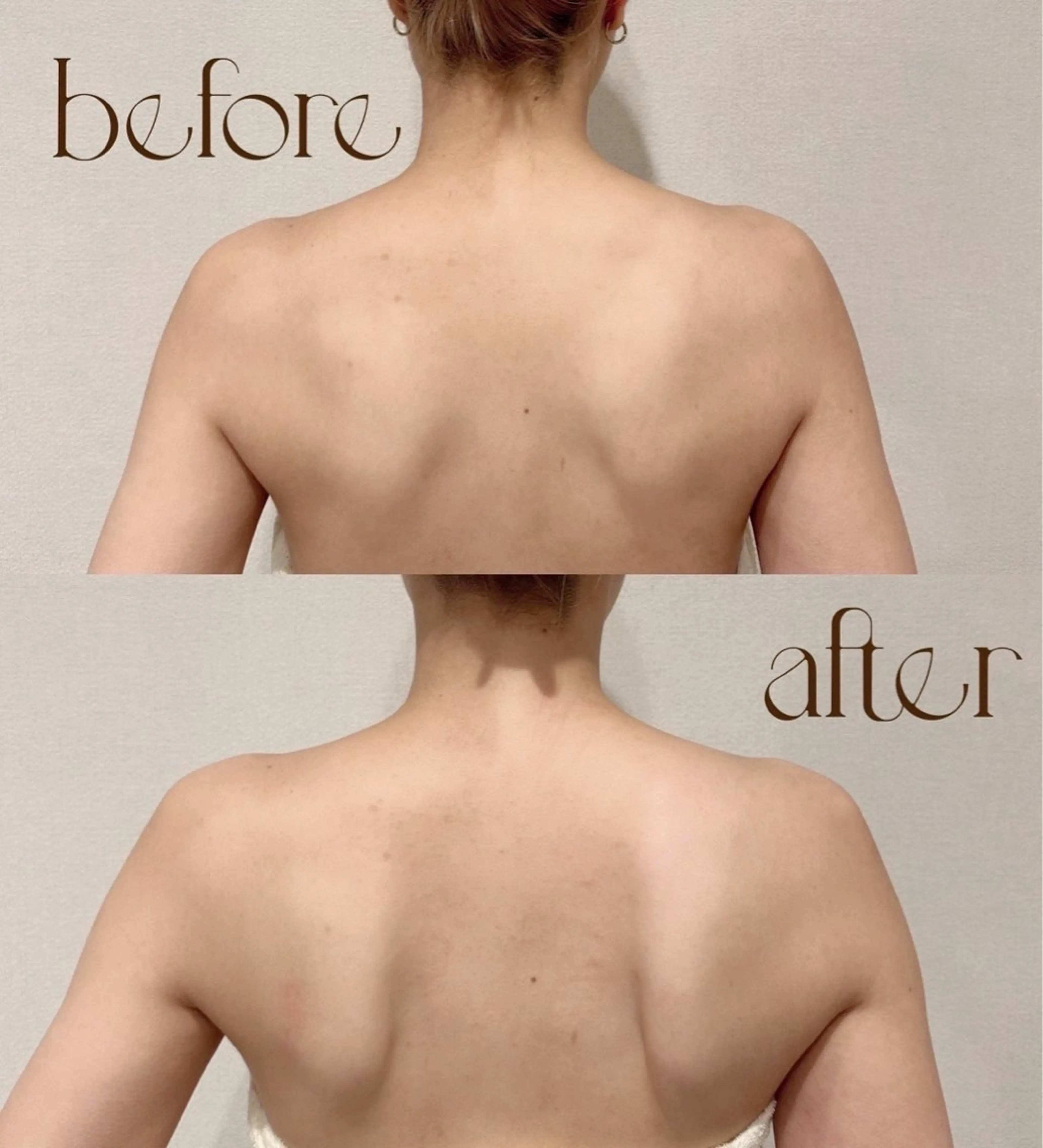 【疲労回復★】たるみ・肩こり・腰のだるさに！小顔×姿勢調整90分の写真