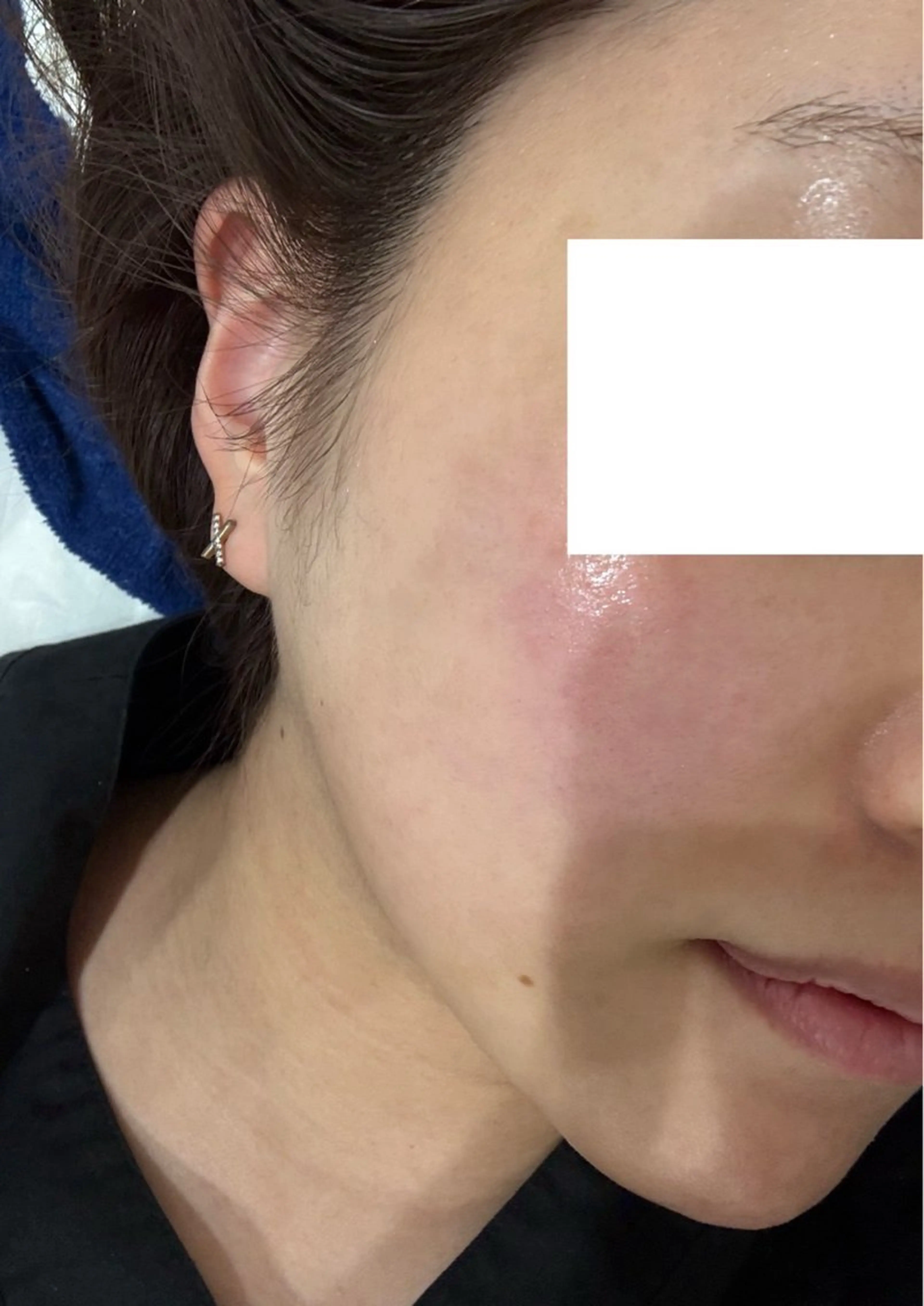 マツエク・マツパ エステ リラク 愛維美水光美肌専門店所属・愛維美水光美肌専門店 メンズレディースokのエステ・リラクイメージ