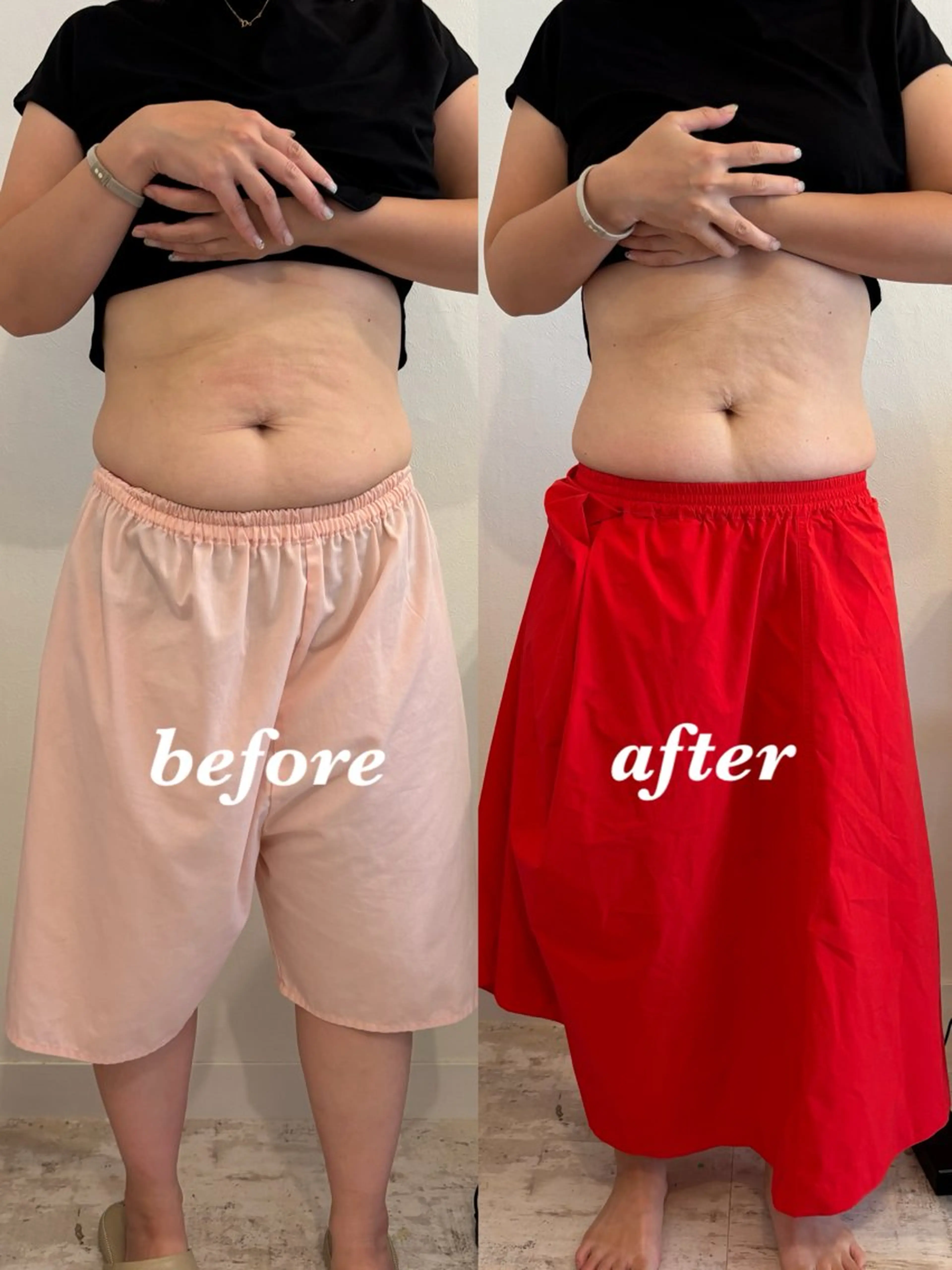 その他 腸活サポート みなみののエステ・リラクイメージ