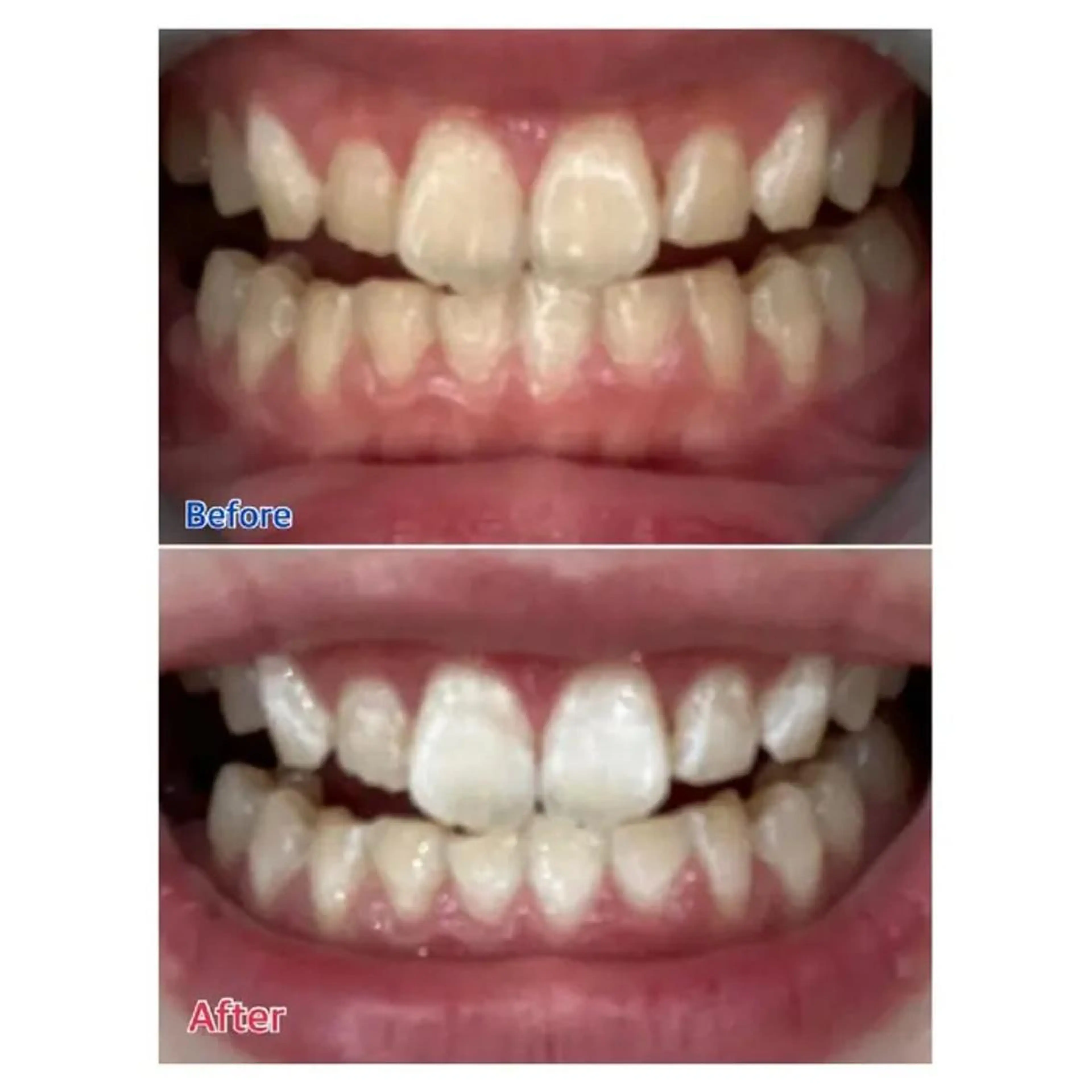 M渋谷 ホワイトニングのエステ・リラクイメージ