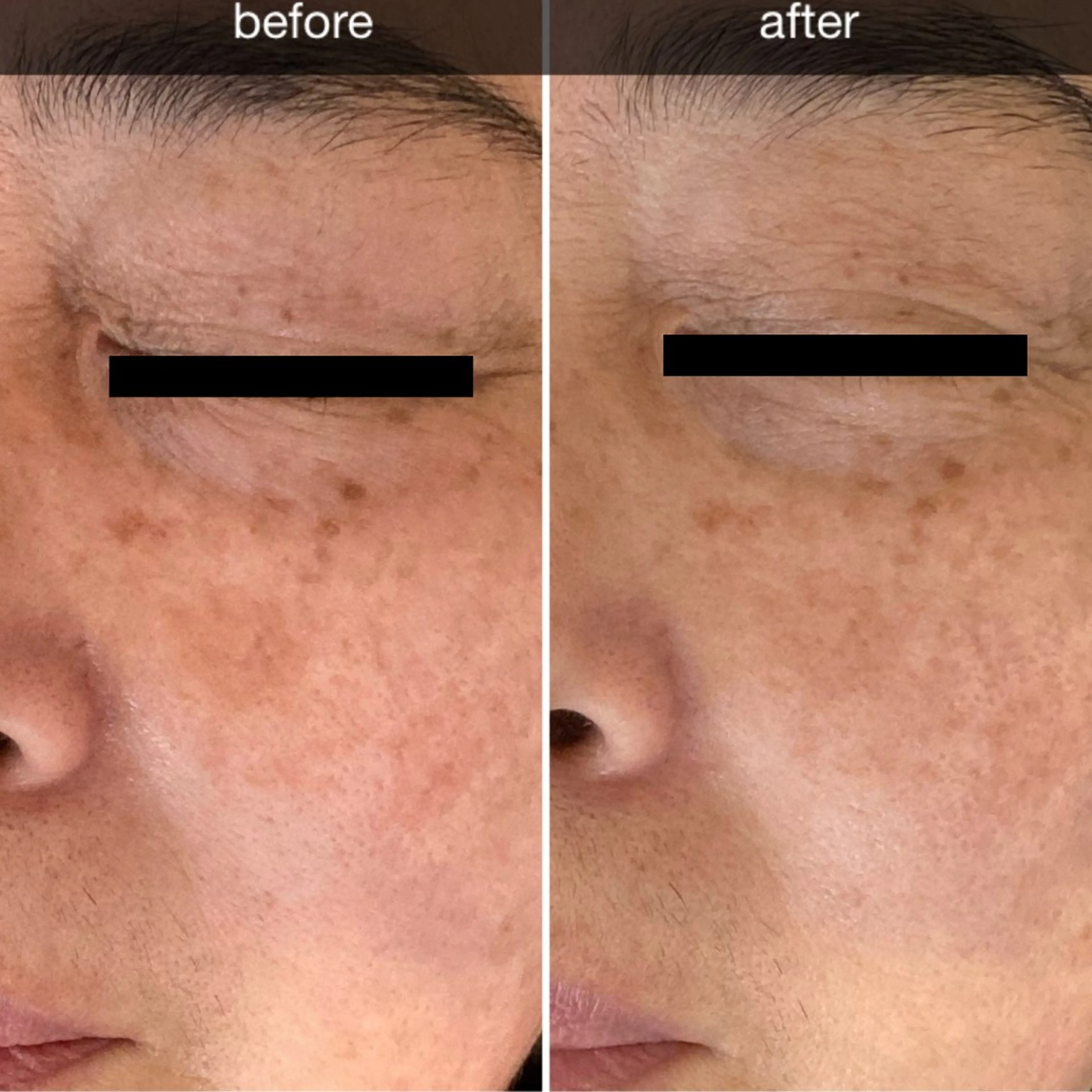 プレジール所属・ビューティサロン プレジールOTAKEのエステ・リラクイメージ