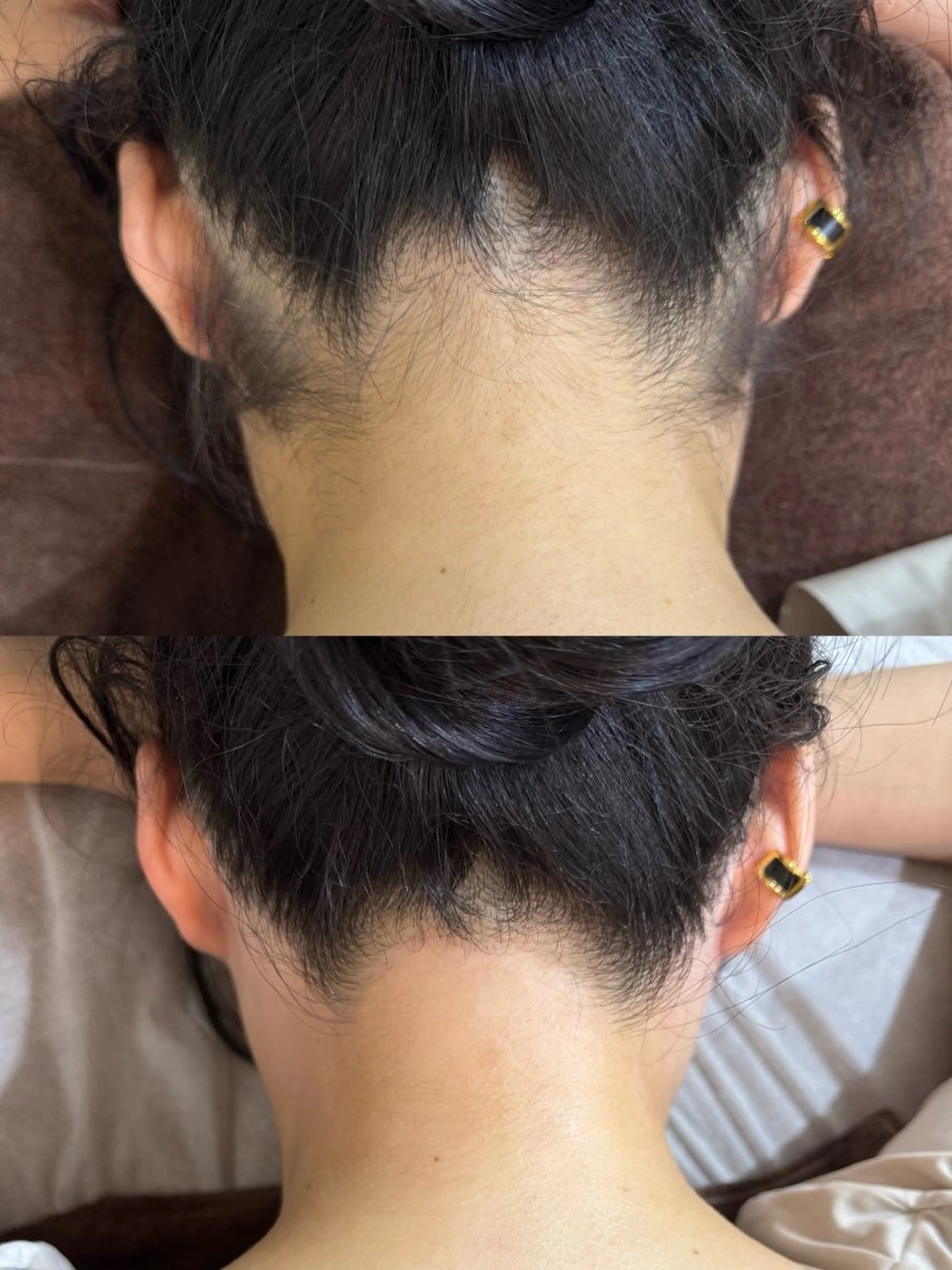 【女性🎀】うなじワックス脱毛◽️ダブル脱毛に変更+2000円の写真