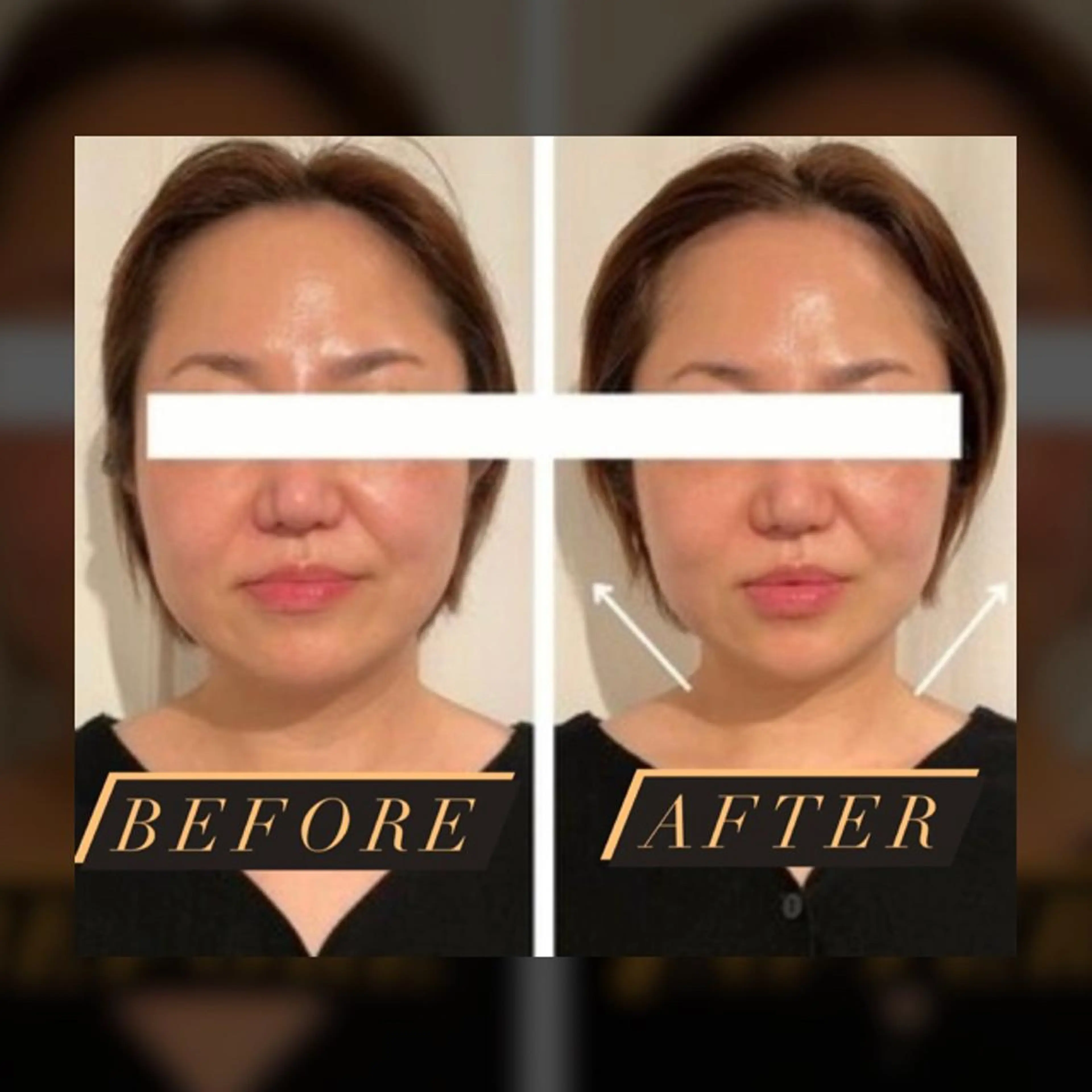 Lam..肌質改善 専門 女性専用サロンのエステ・リラクイメージ