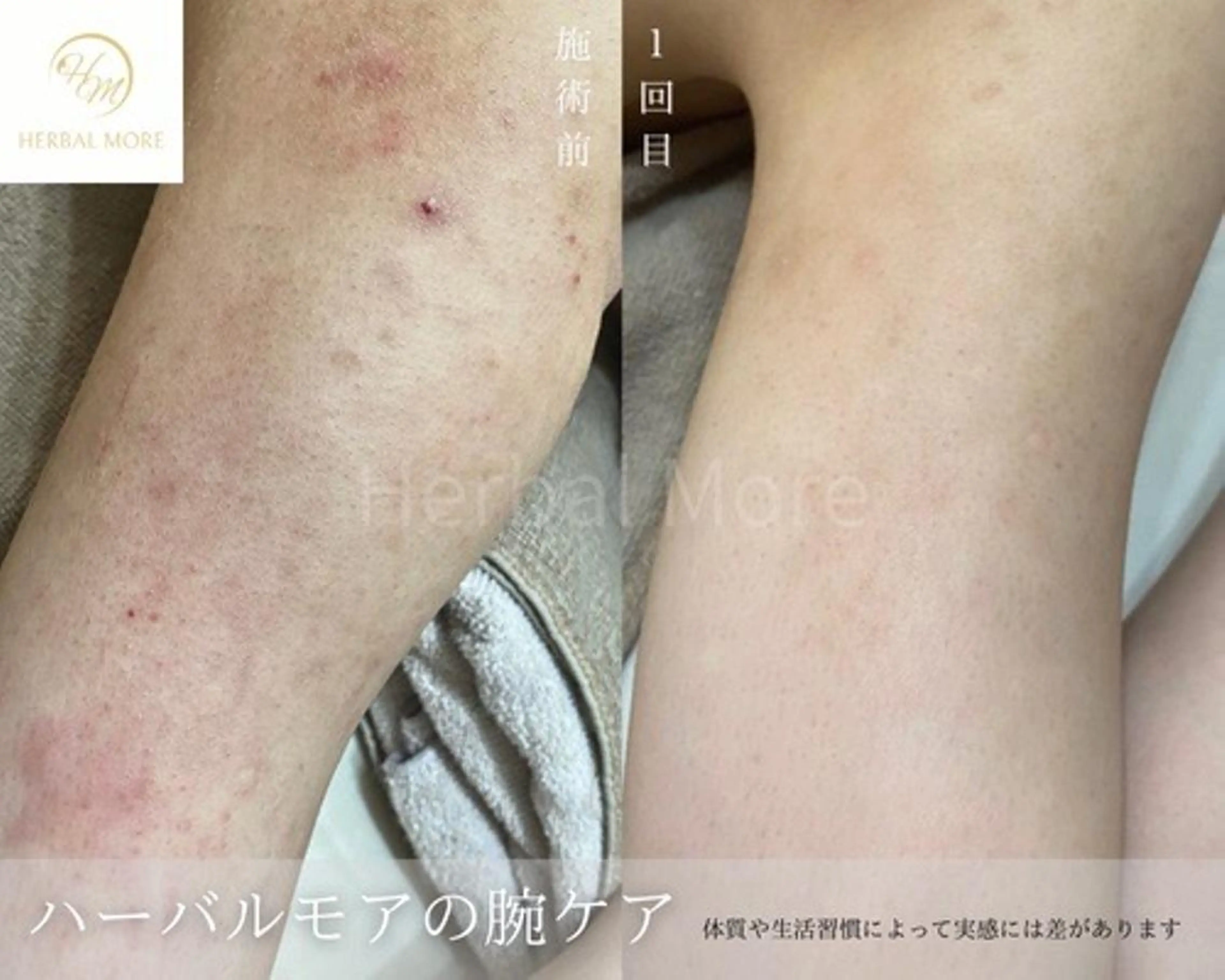 脱毛・眉毛・フェイス サロンN久留米店の眉毛・アイブロウイメージ