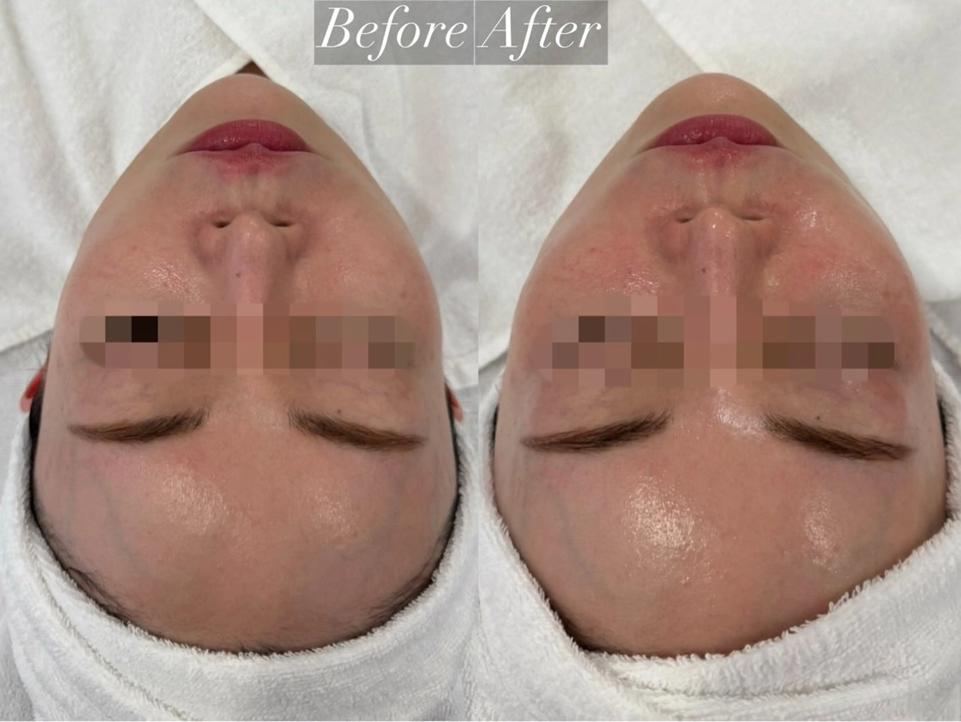 エステ richeri beautyのエステ・リラクイメージ