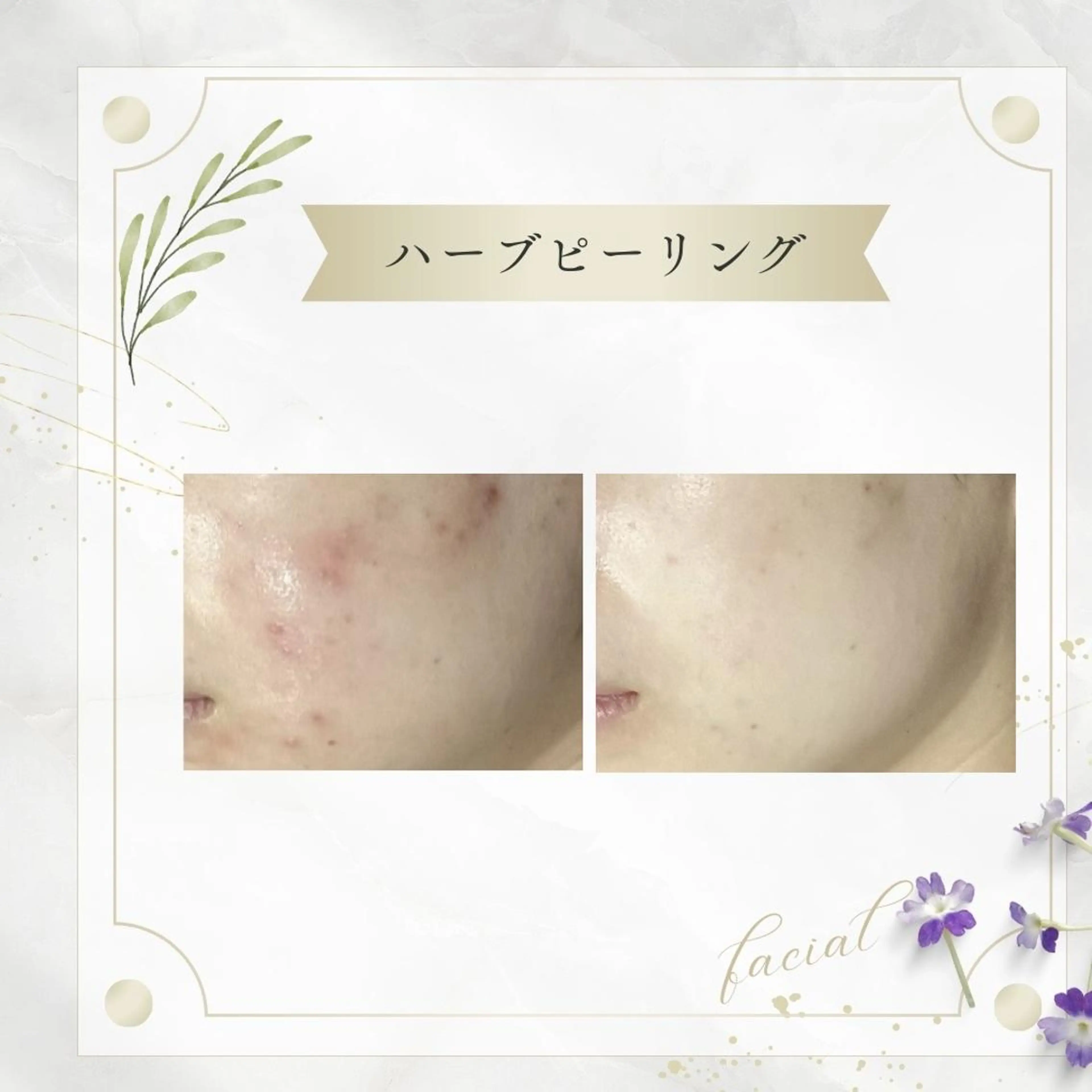 《 肌質×美肌 》 addissimoのエステ・リラクイメージ