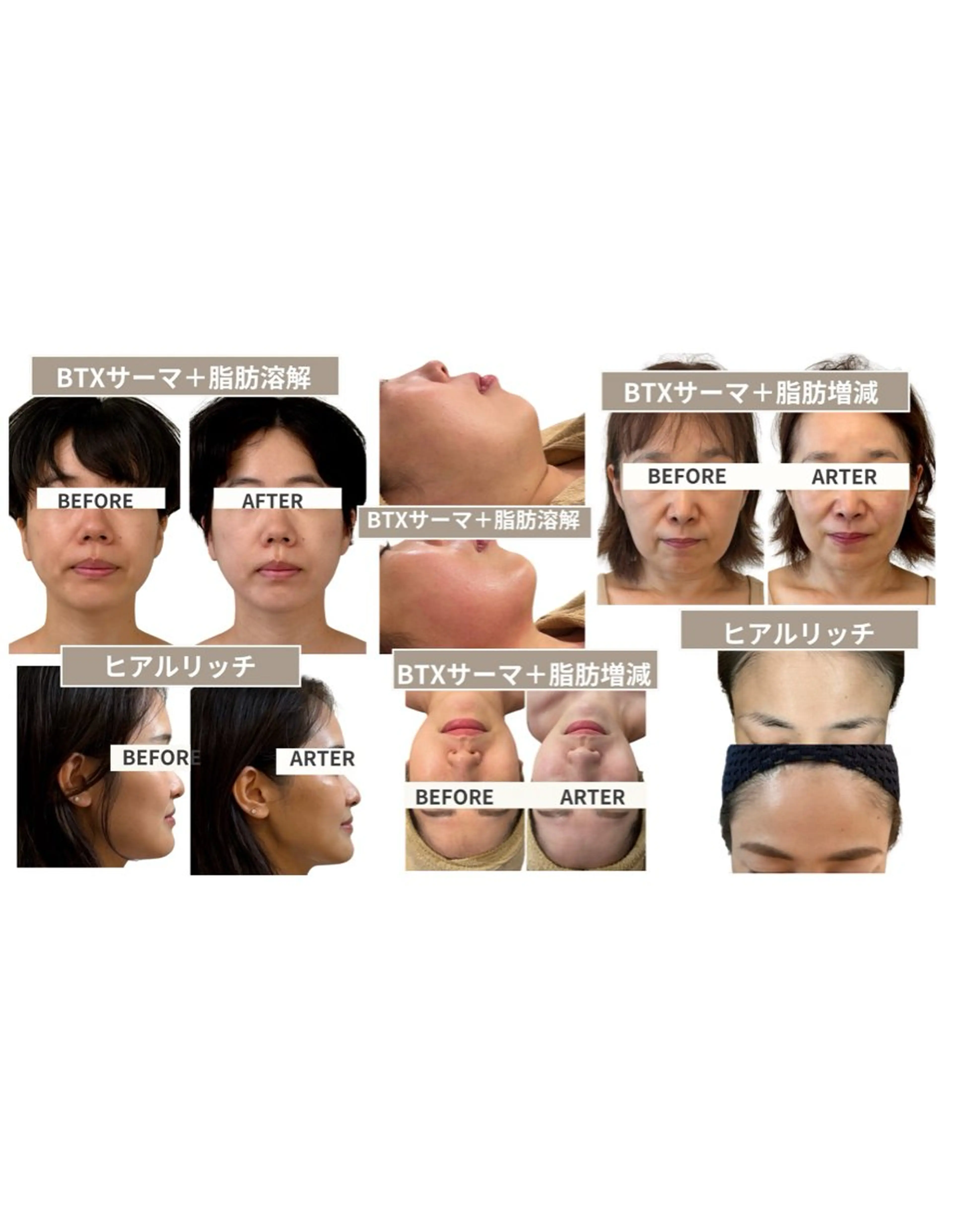 小顔専門看護師クリニカルサロンCOCO所属・小顔と美肌サロン クリニカルサロンココのエステ・リラクイメージ