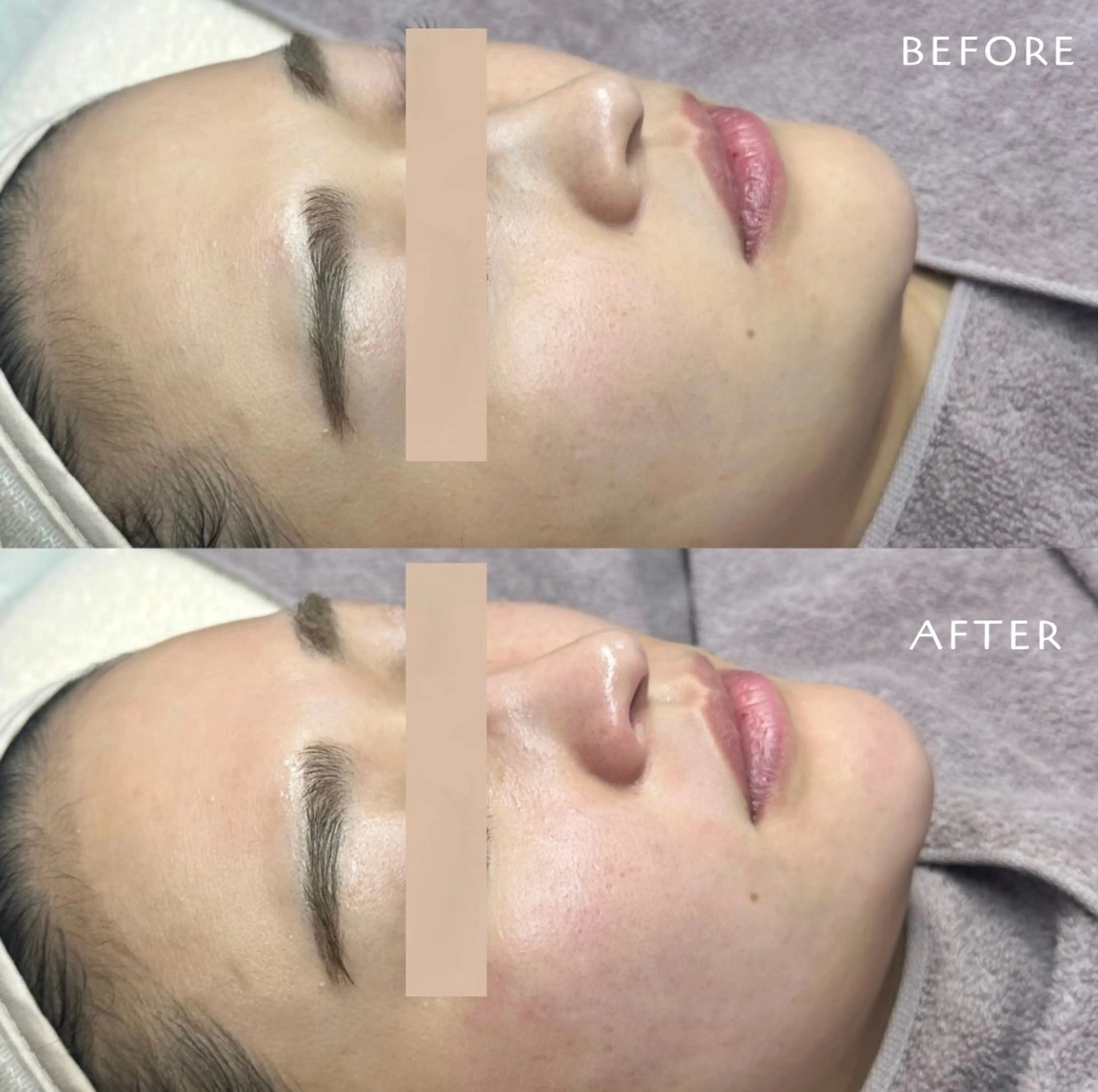 脱毛 フェイシャルワックス KANAKOのエステ・リラクイメージ