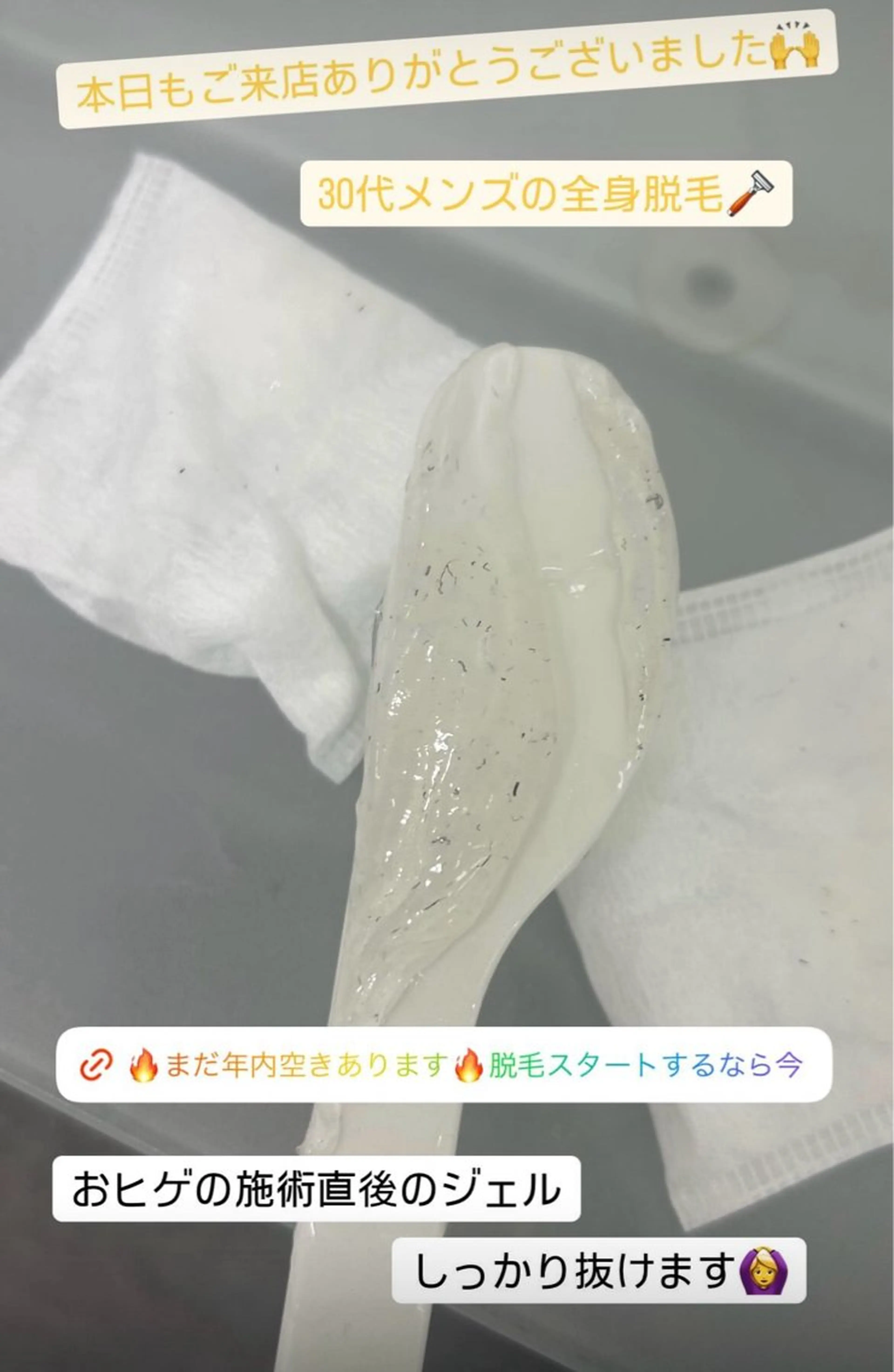 メンズ 脱毛 脱毛サロン BRIDGE橋本のエステ・リラクイメージ