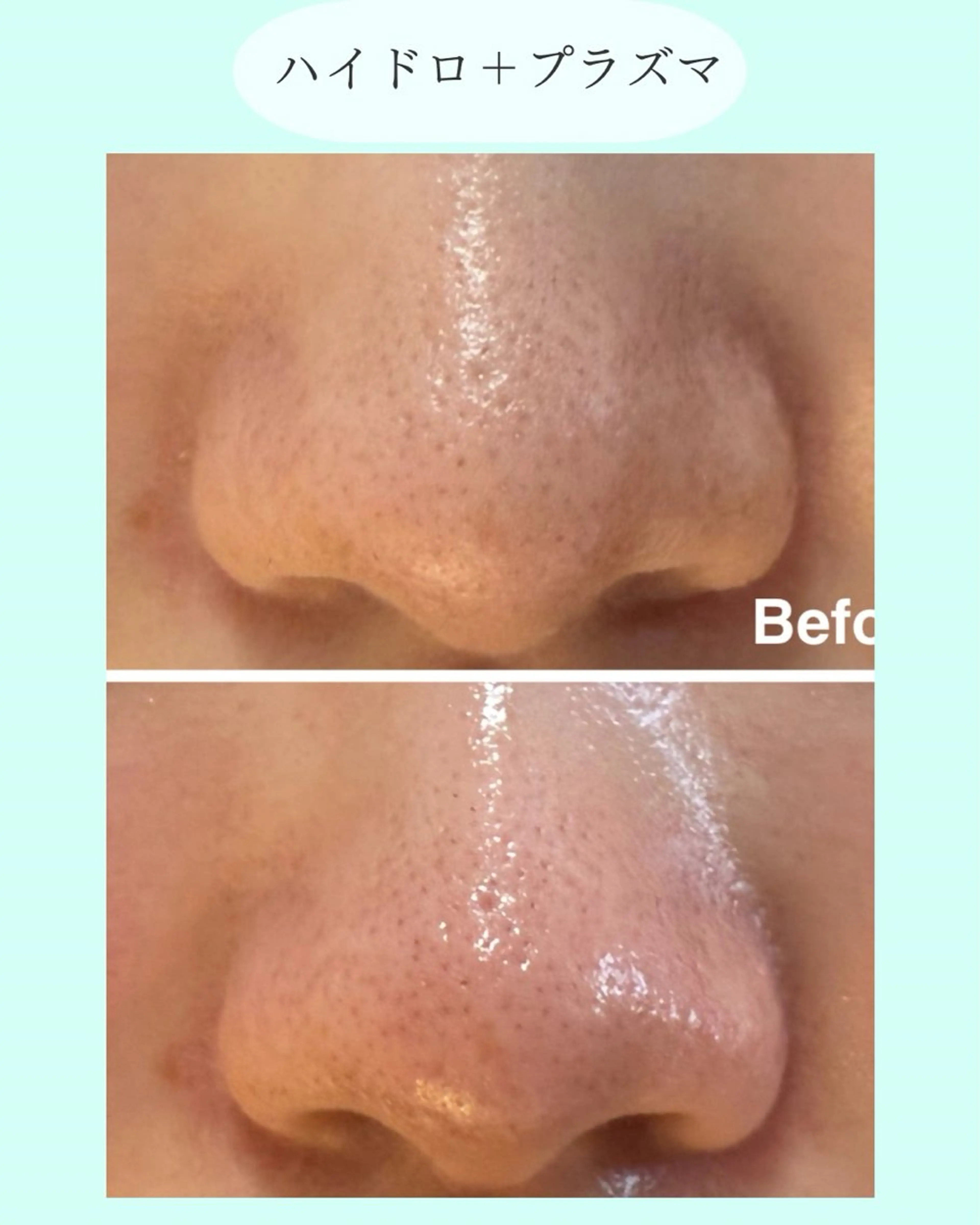 エステ NICORI　小顔&肌質改善専門店所属・小顔＆肌質改善 NICORIのエステ・リラクイメージ