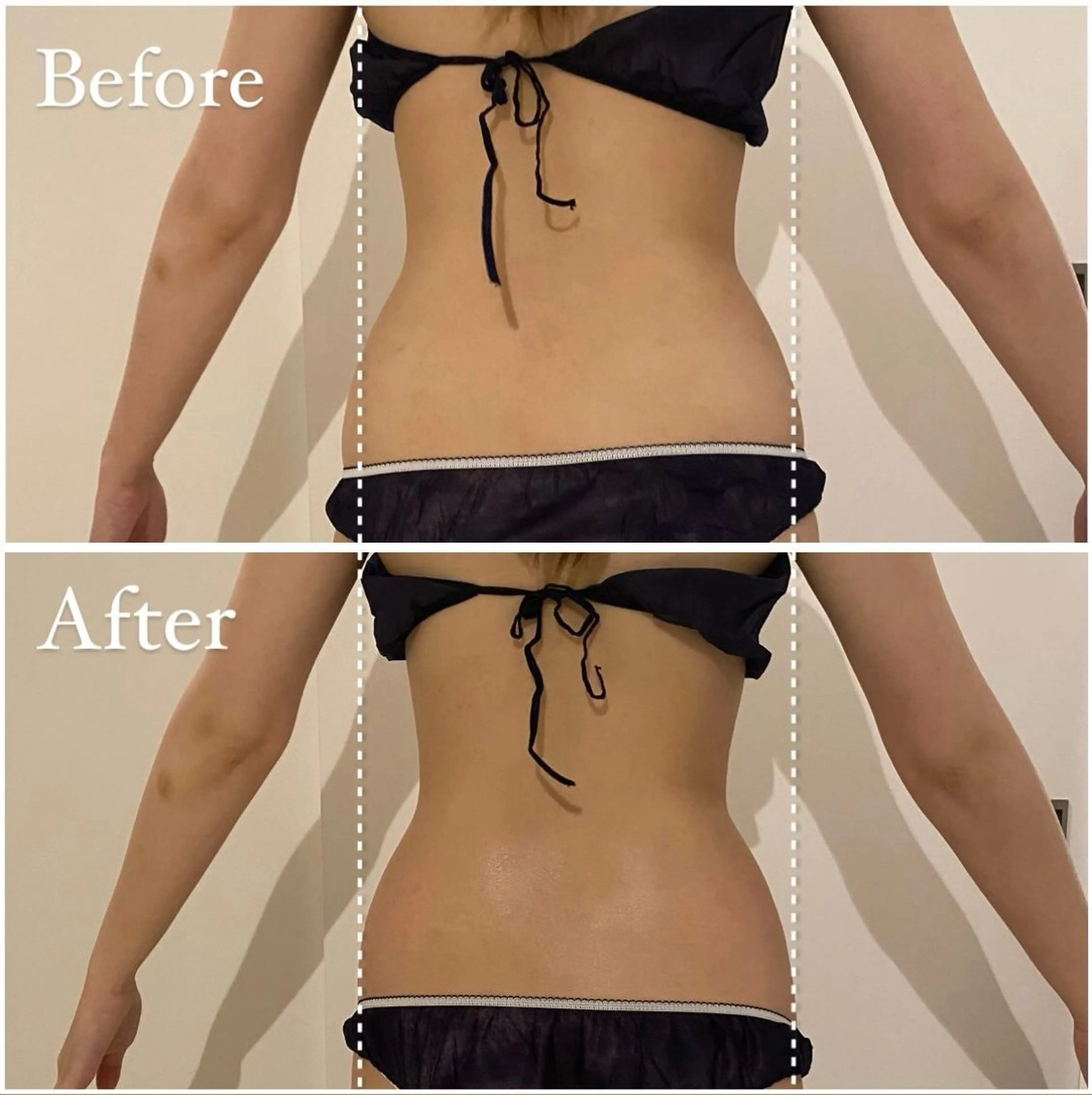 エステ リラク LibCharm🩰 村山美咲のエステ・リラクイメージ