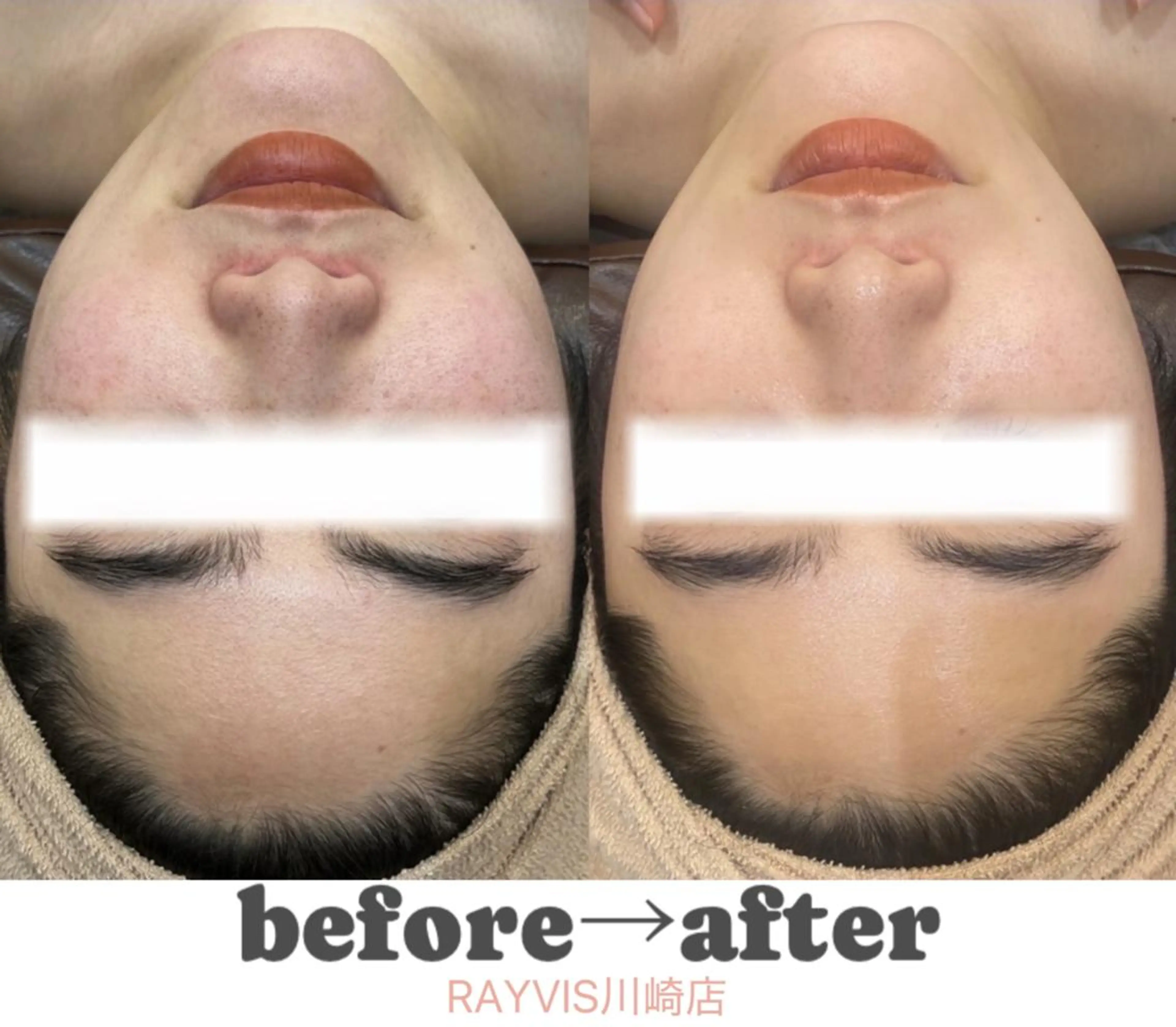 🌷毛穴エステ レイビスMURA🌷のエステ・リラクイメージ