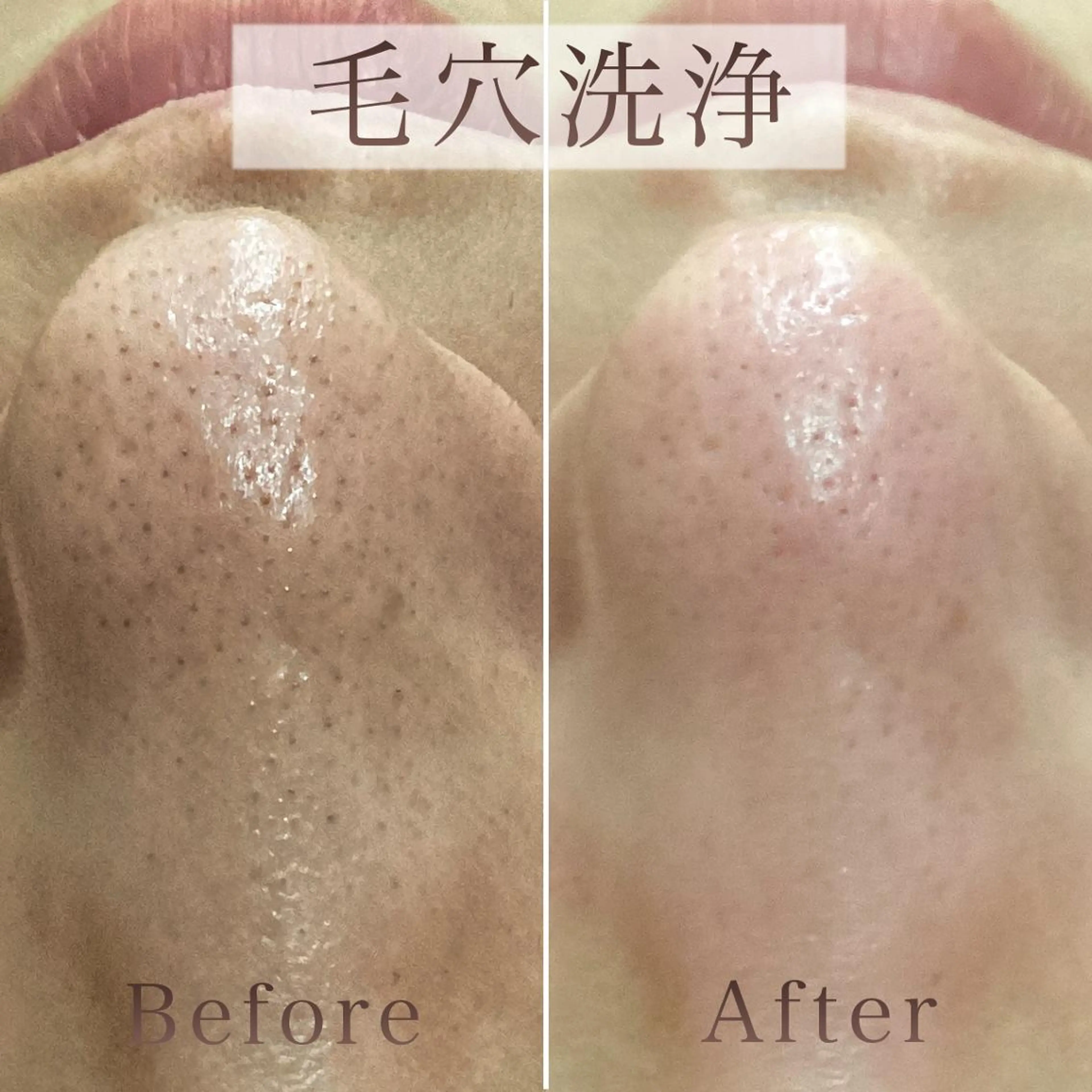 エステ リラク 【毛穴洗浄・小顔】 セラピスト　和田紋子のエステ・リラクイメージ