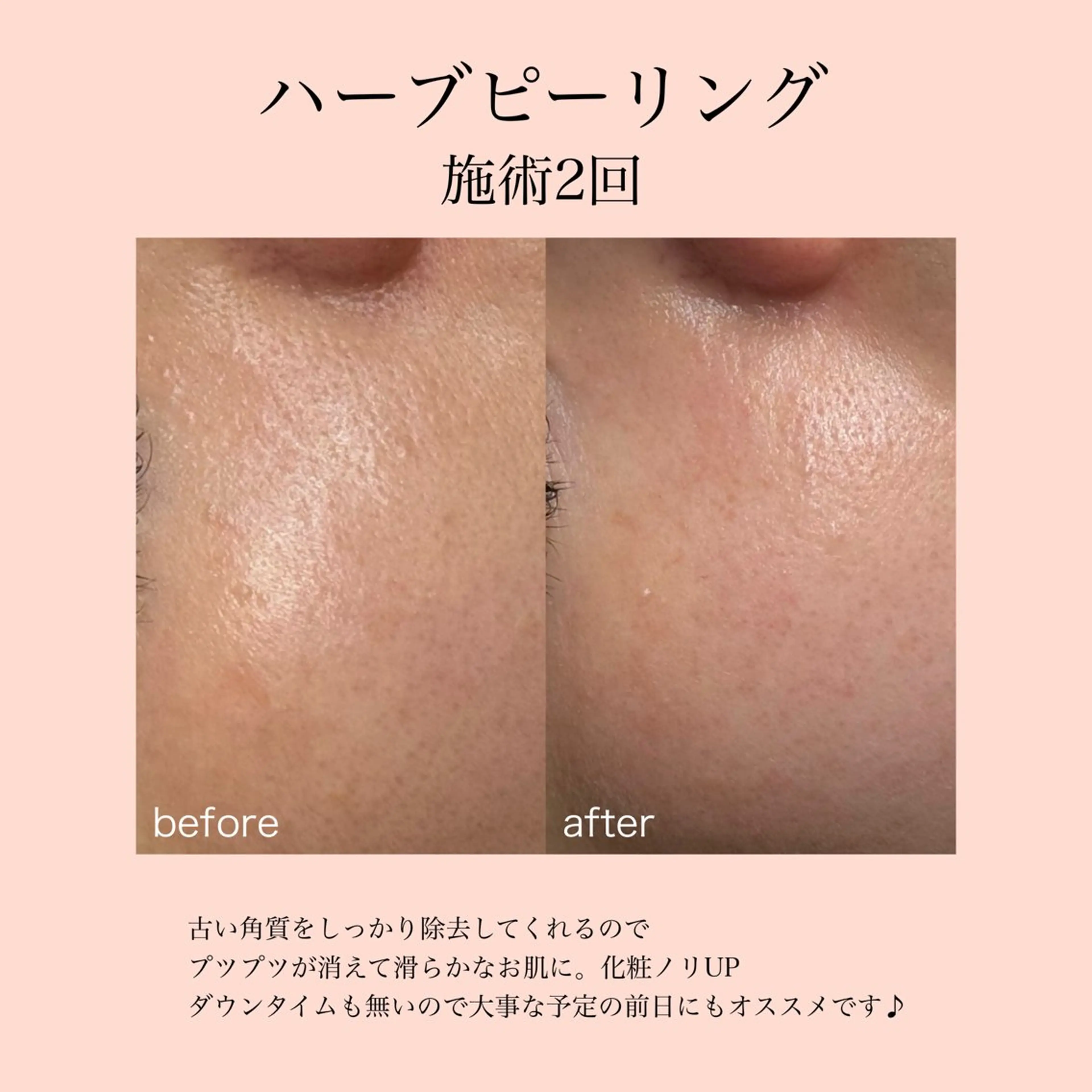 エステ 肌質改善×癒しサロン Bell skinのエステ・リラクイメージ