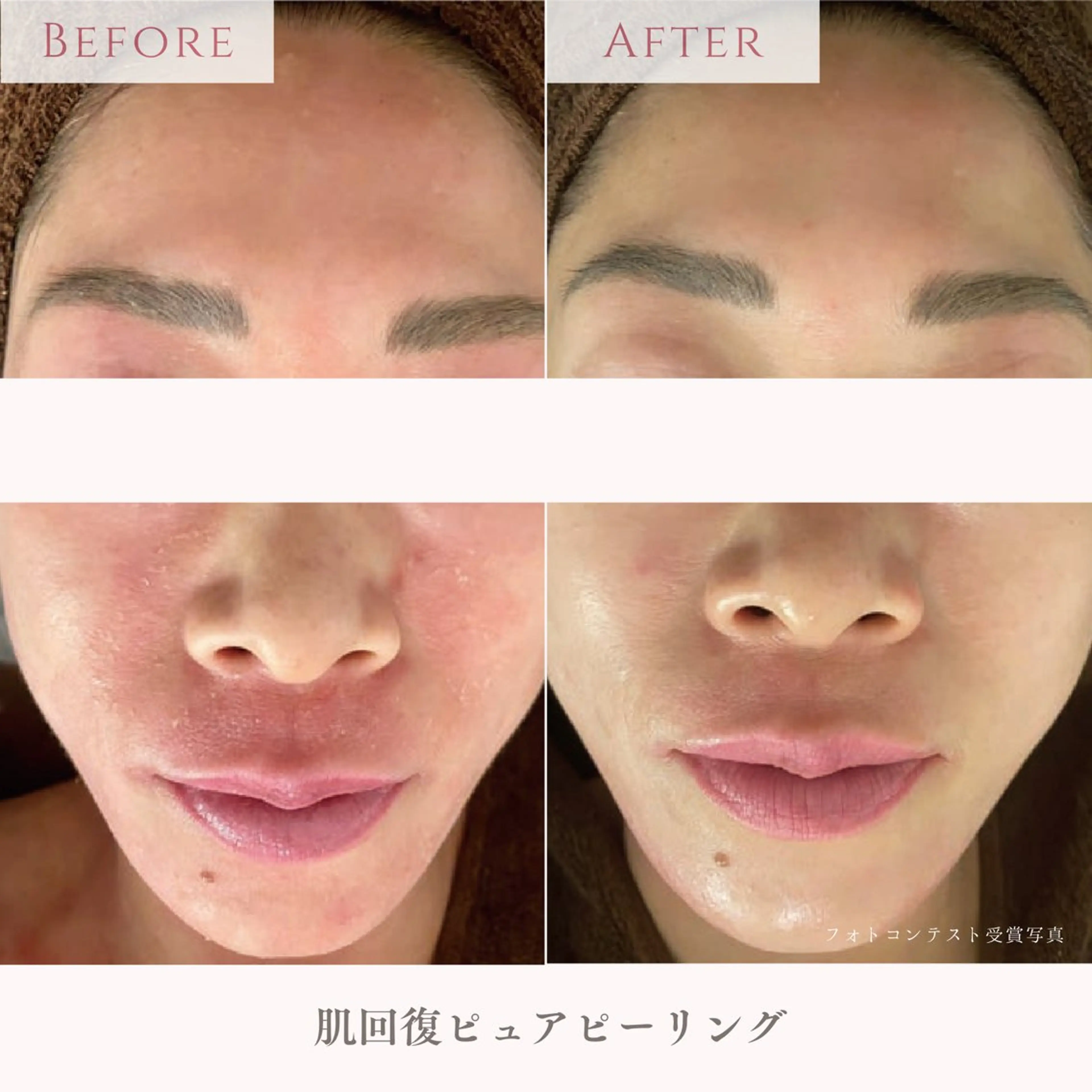 エステ 肌質改善サロン LesFleursのエステ・リラクイメージ