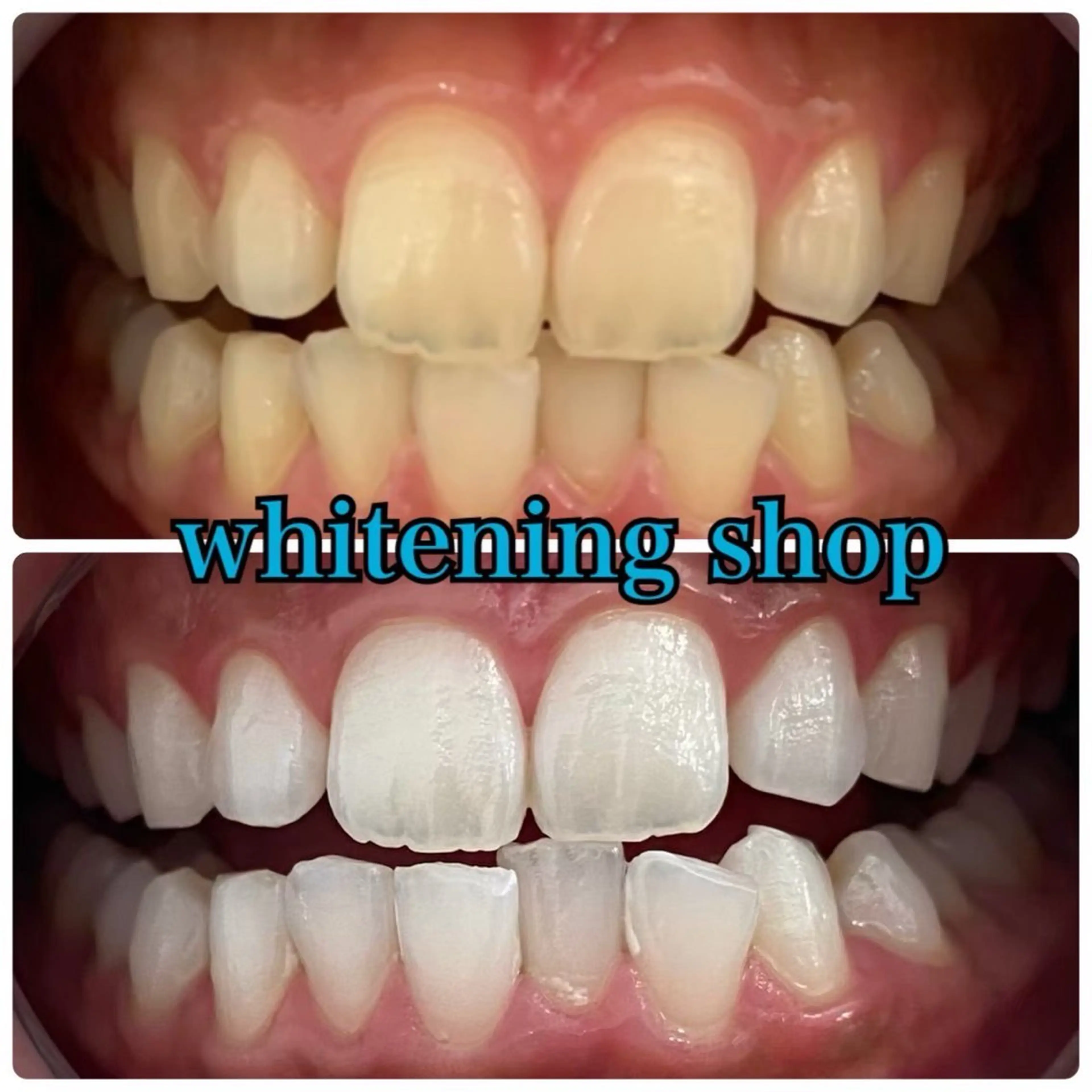 その他 ホワイトニングショップせんげん台店所属・スタッフ 兎洞のその他イメージ