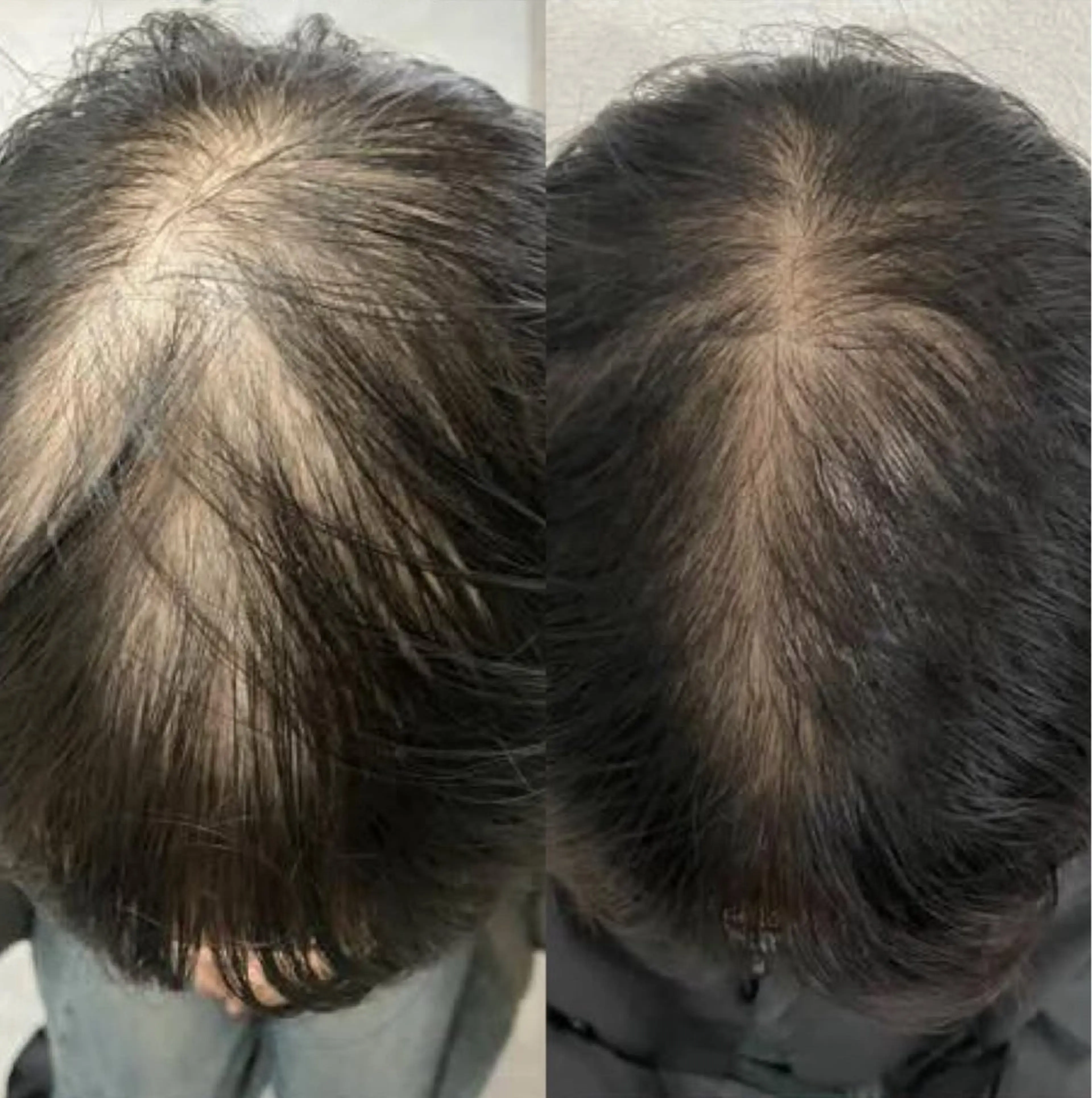 Blooming所属・LOUISE. ／肌質・頭皮のエステ・リラクイメージ