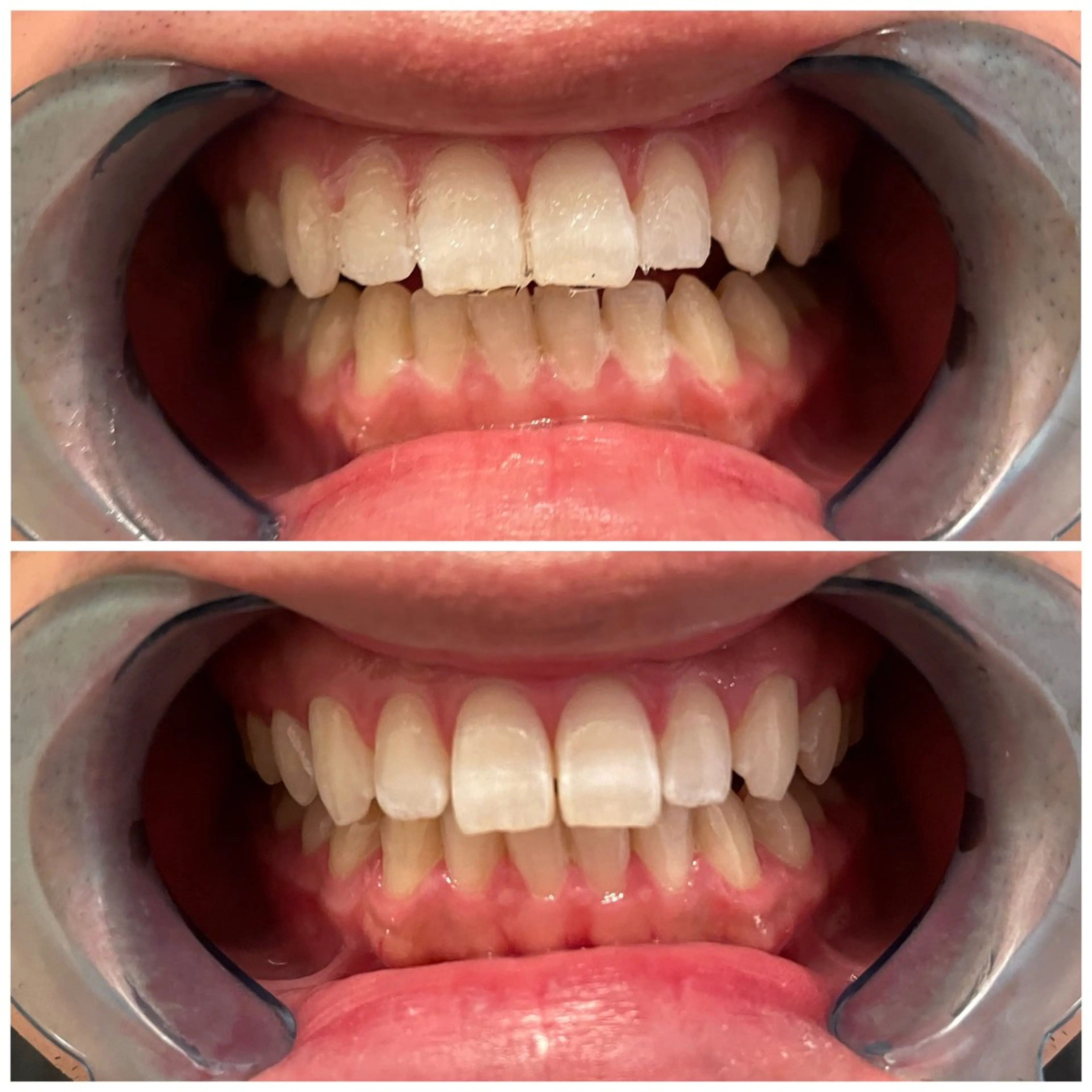 DIAMOND BEAUYのその他イメージ