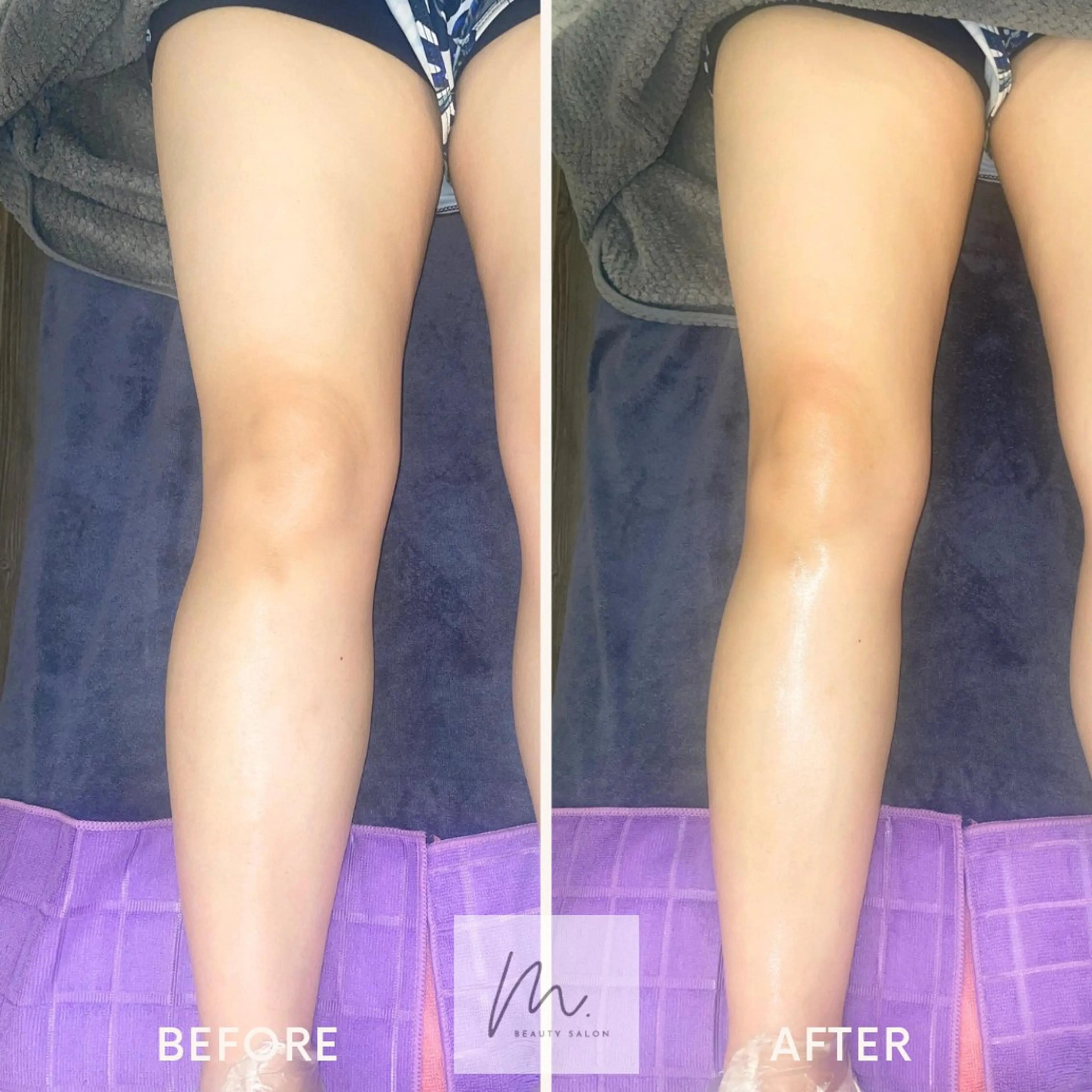 SHARES MADOKAのエステ・リラクイメージ