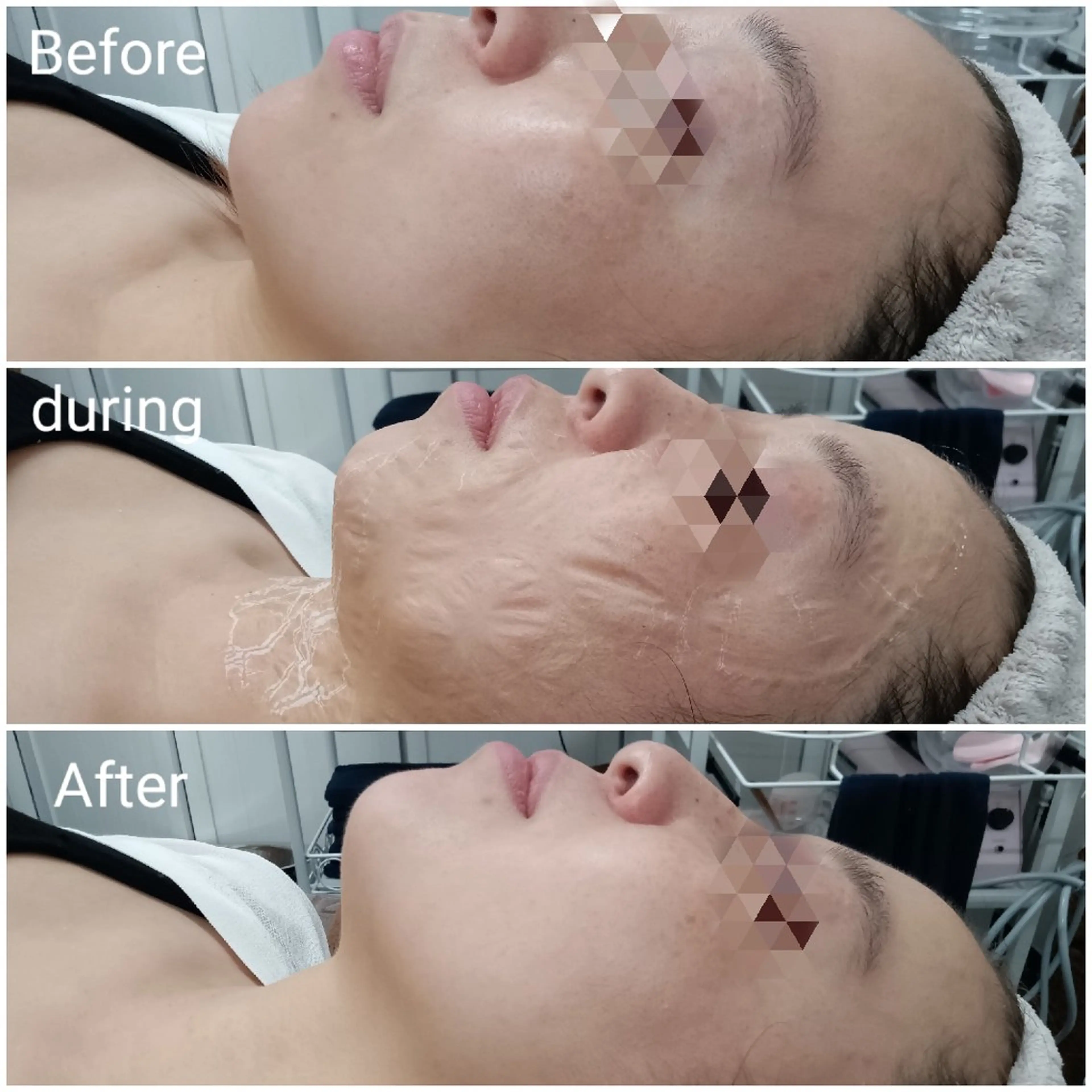 エステ リラク 肌質改善Beauty salon Renのエステ・リラクイメージ