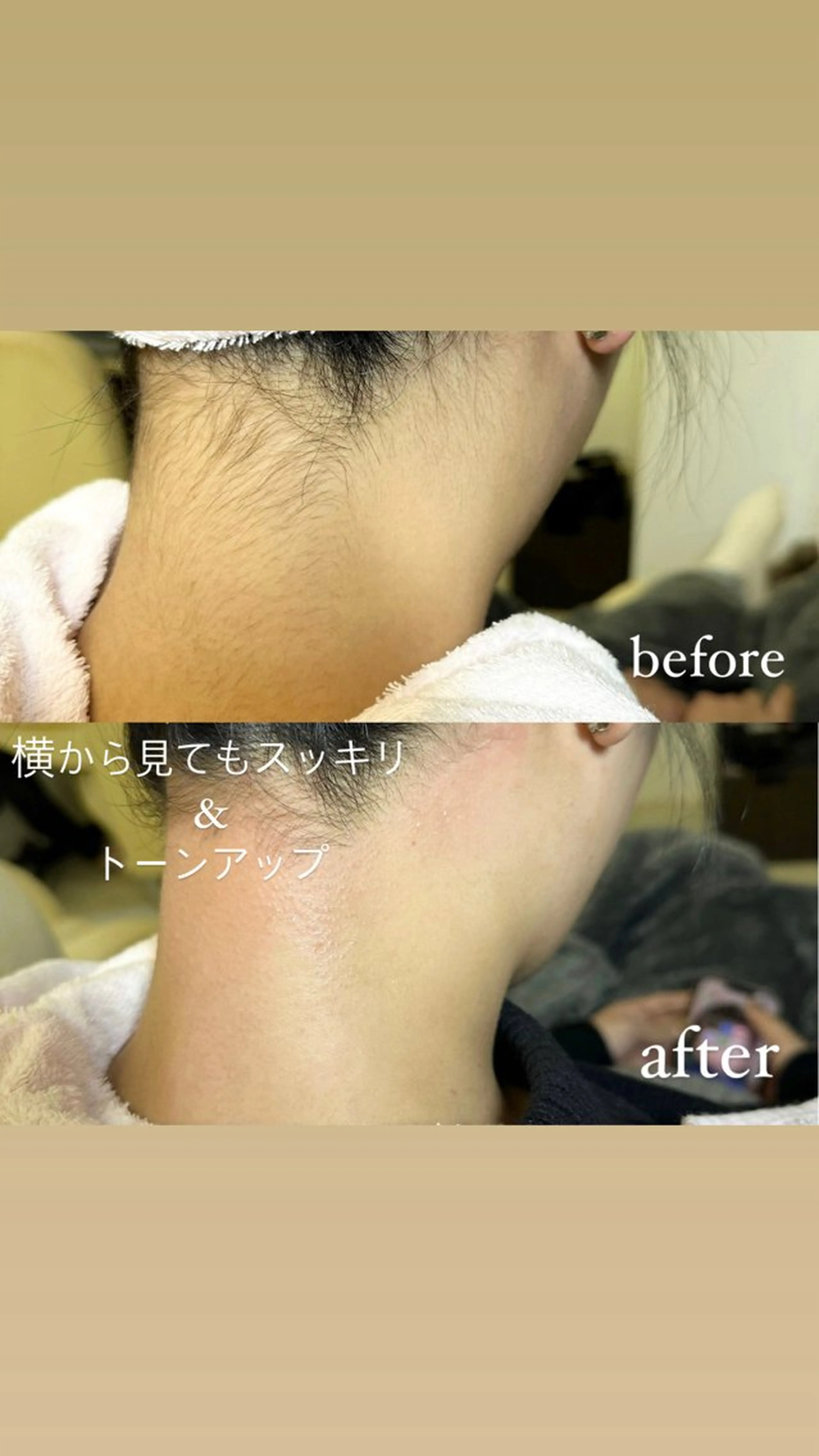 🌿うなじワックスの写真