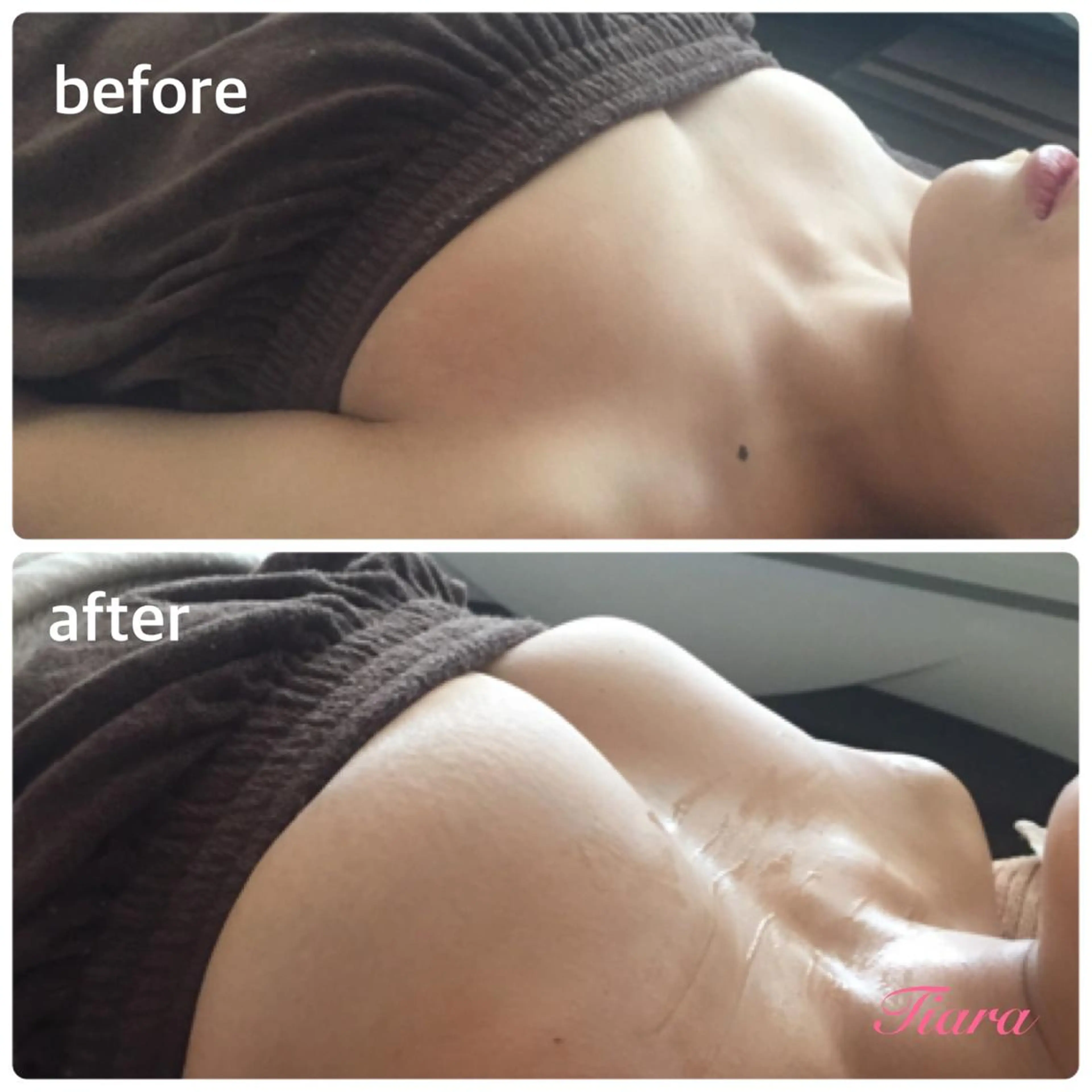 Tiara所属・冨樫 倫子のエステ・リラクイメージ