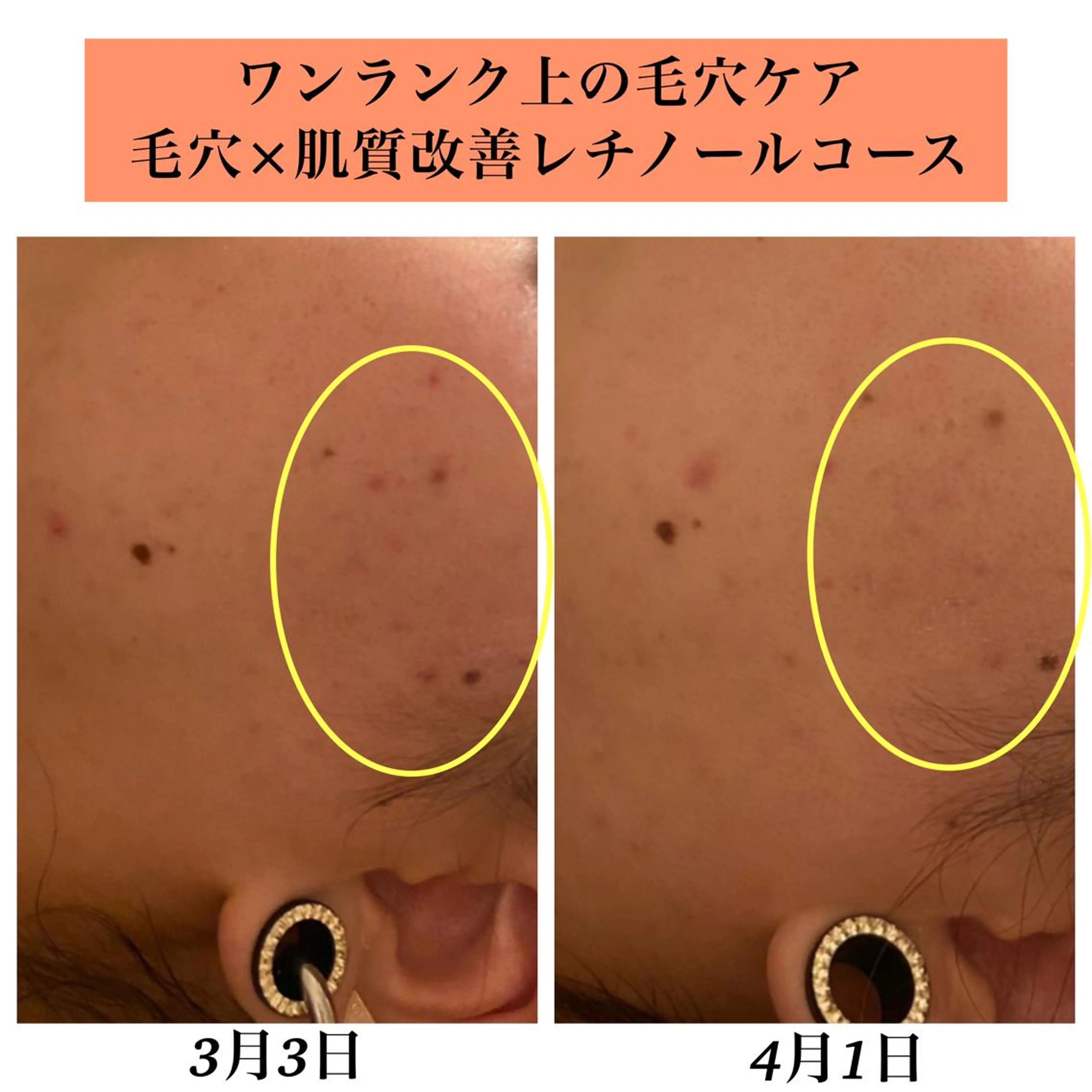 エステ リラク Bellesthe (ベルエステ)のエステ・リラクイメージ