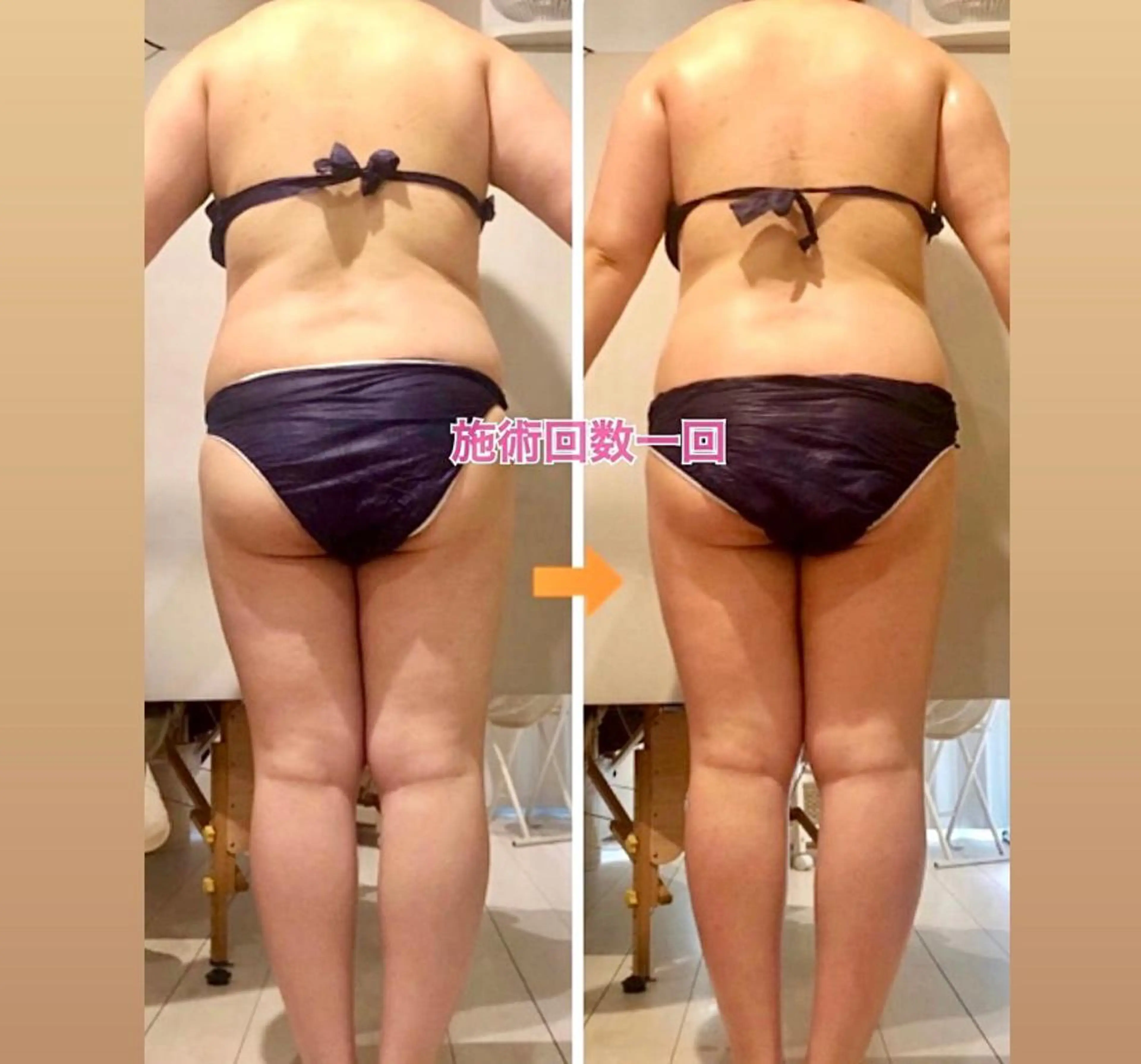 ショート カラー パーマ ヘアアレンジ メンズ キッズ ネイル マツエク・マツパ ‍痩身＆ボディ 結果出し🌟丹野のエステ・リラクイメージ