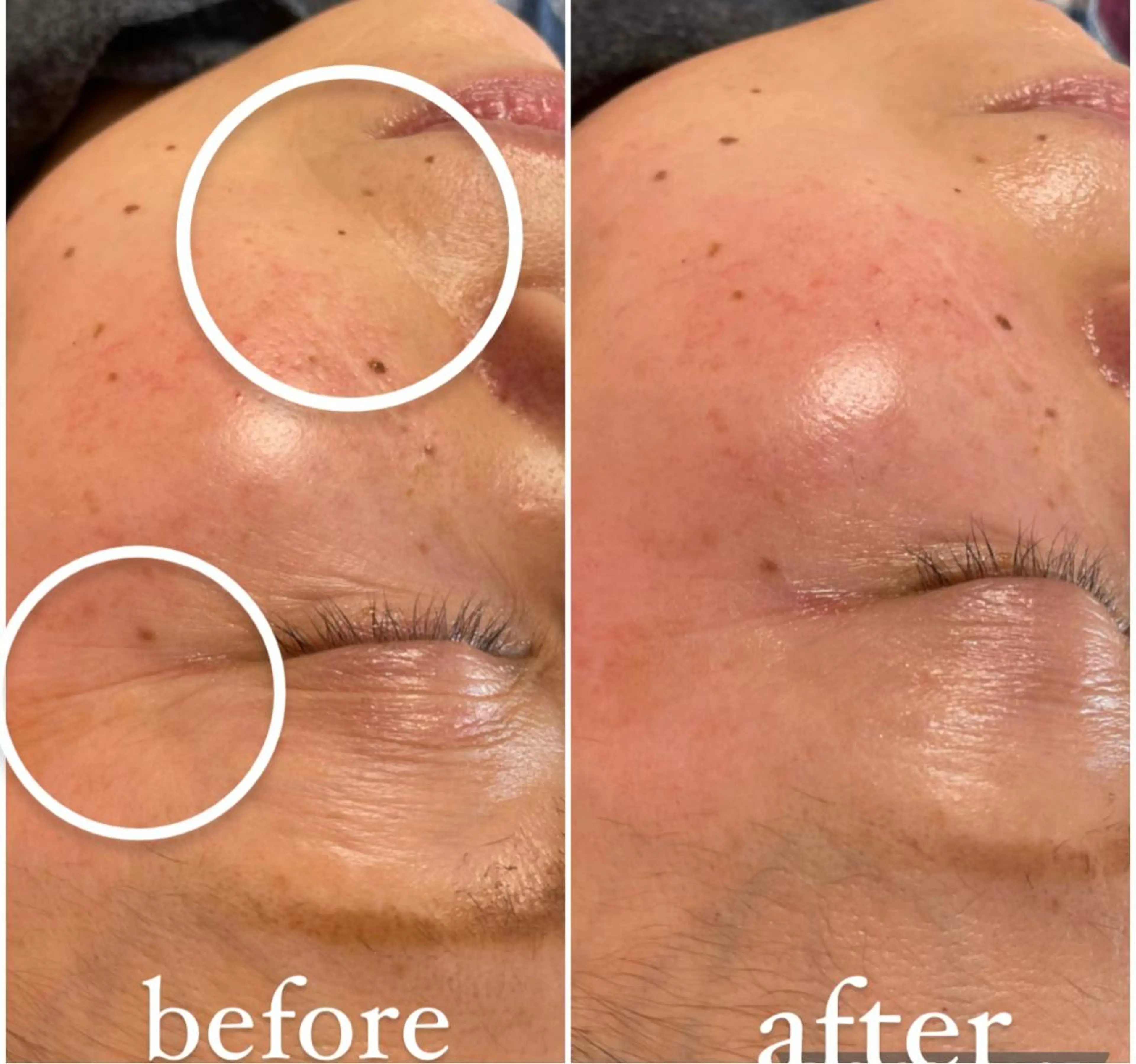 毛穴レス ハーブ＆ ワックス脱毛×光脱毛のエステ・リラクイメージ