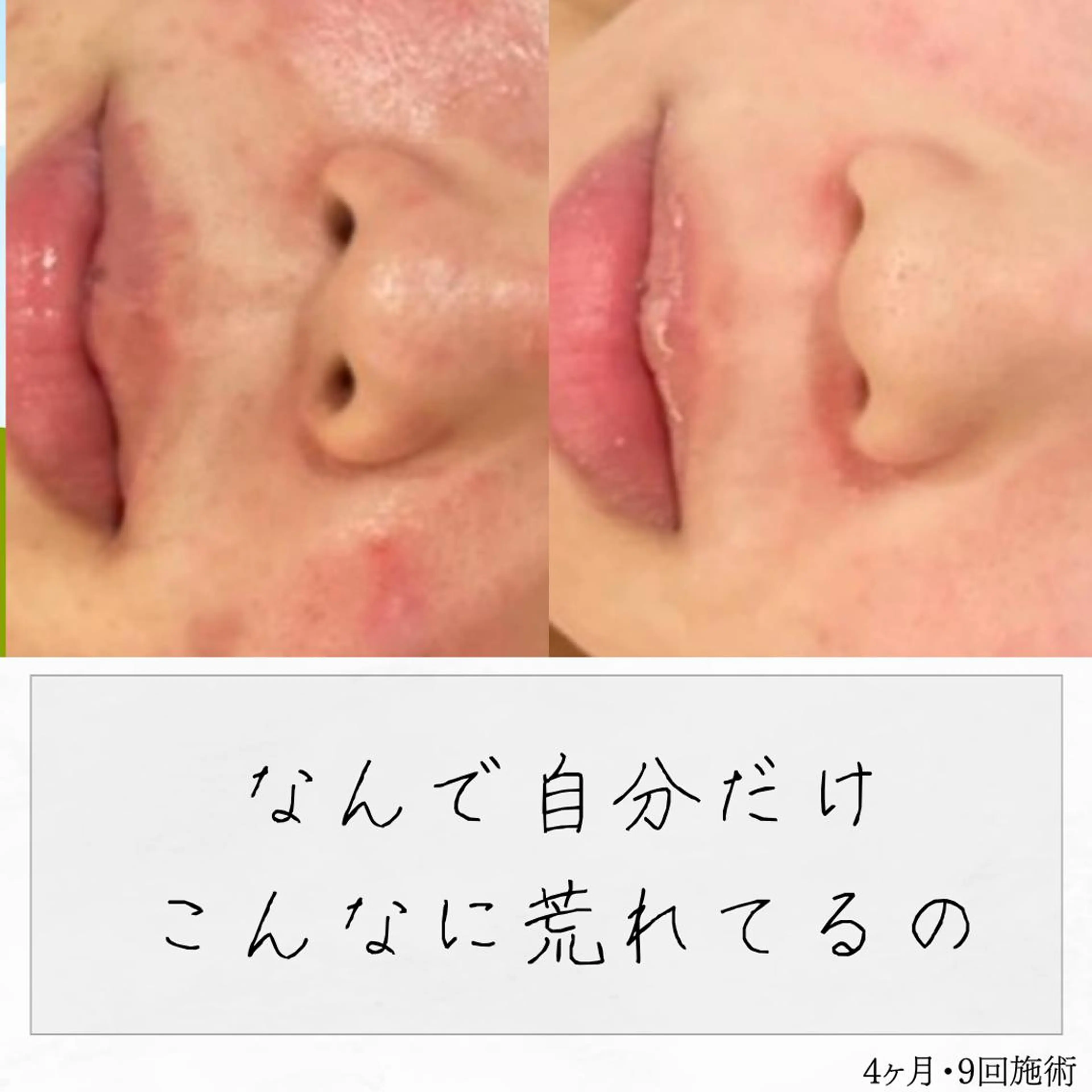 ニキビ経験者が施術 する専門サロン🌻のエステ・リラクイメージ