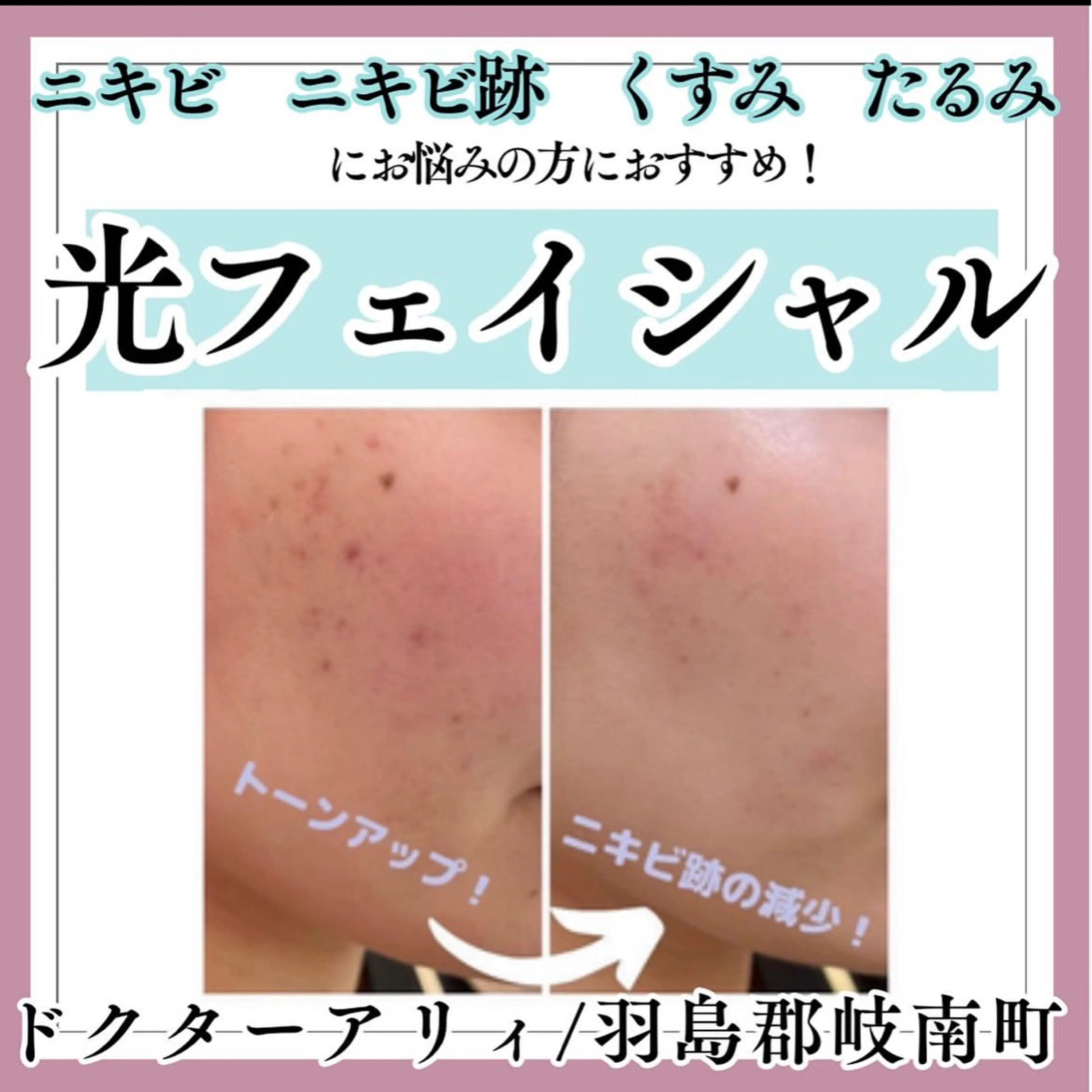 エステ Dr.ALII 岐南店　鈴村のエステ・リラクイメージ