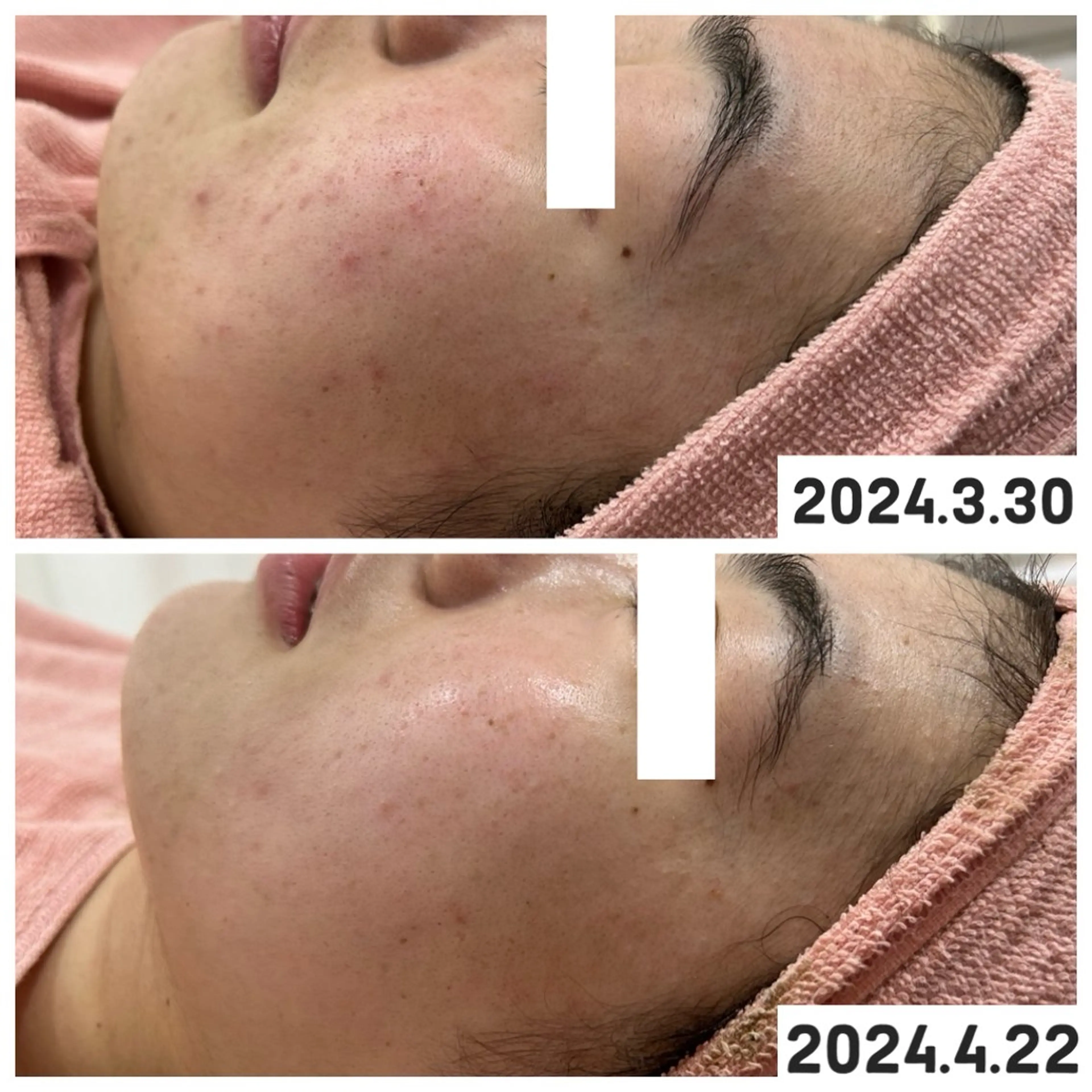 エステ 【現役看護師】高来 笑子のエステ・リラクイメージ