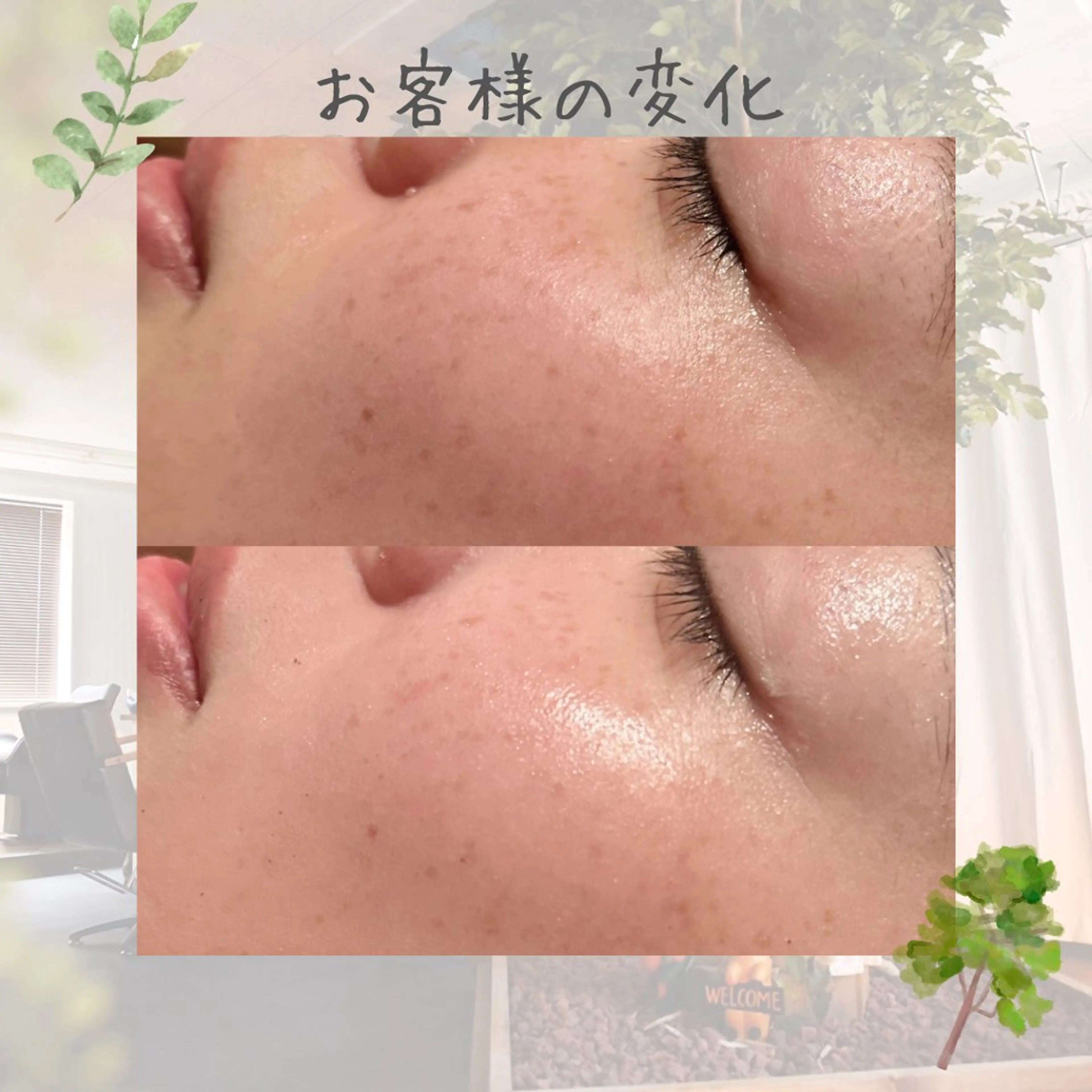 エステ リラク 🌿AQUA南浦和店 MIKIのエステ・リラクイメージ