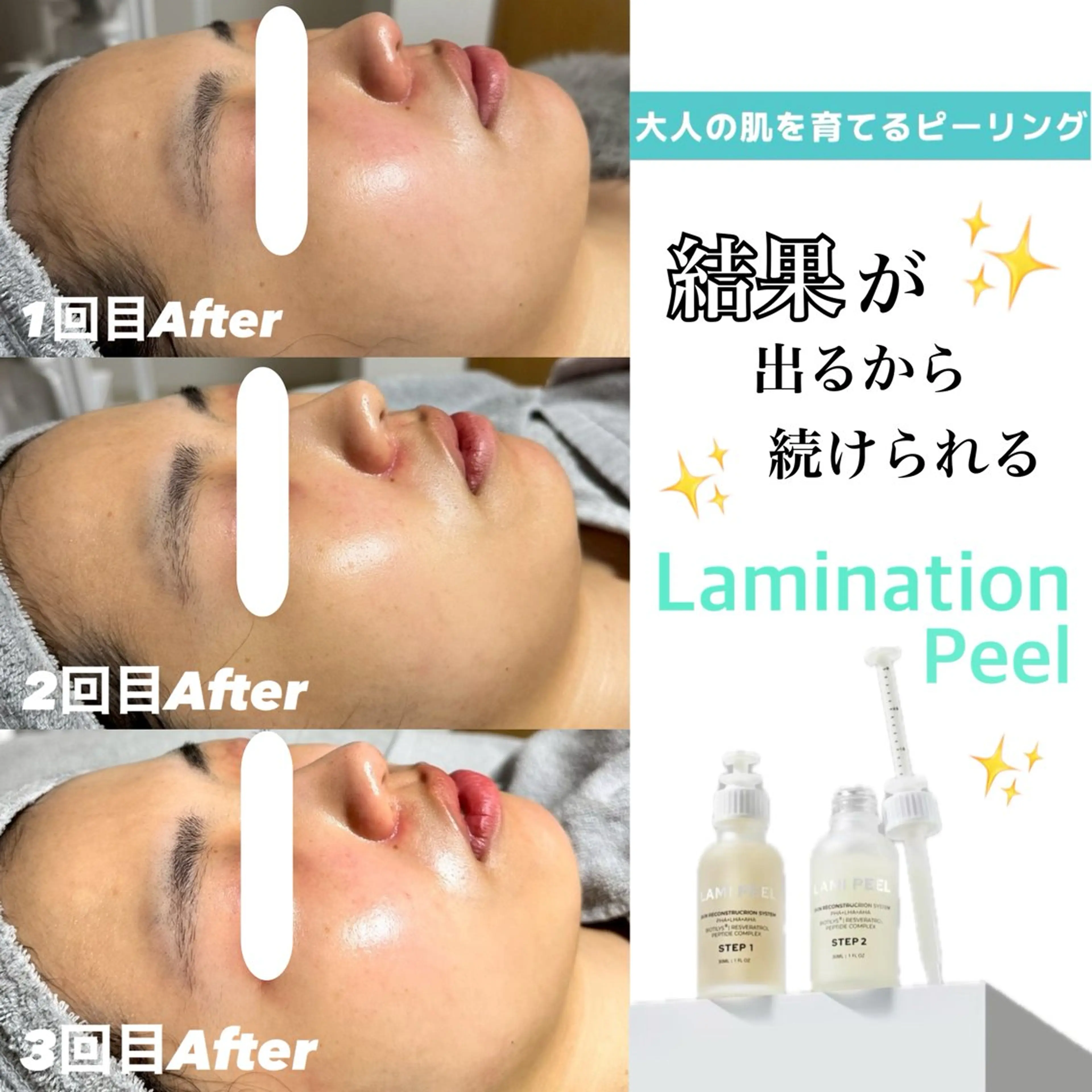 その他 White labo 今村のエステ・リラクイメージ