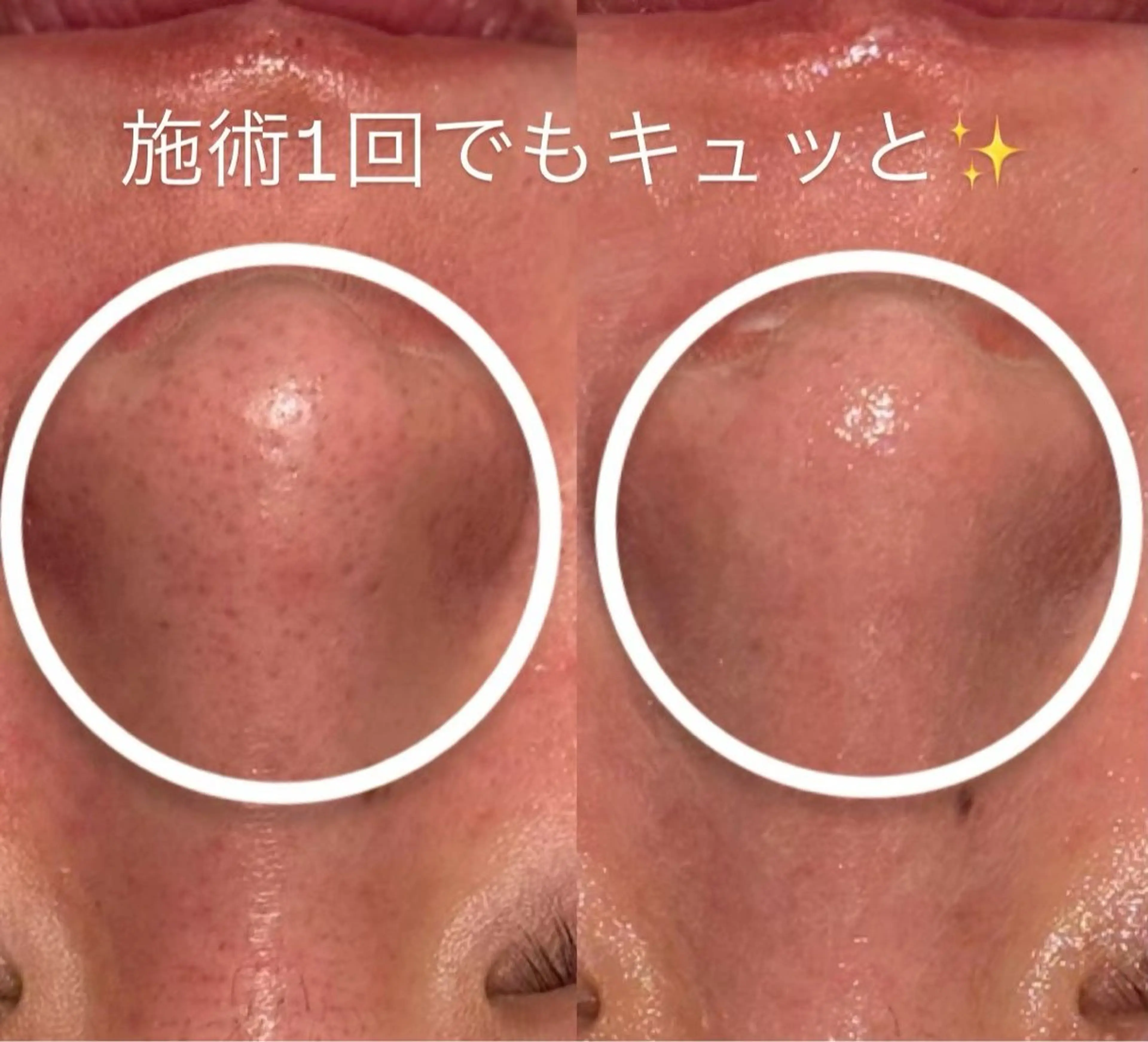 エステ Butterfly 平塚店　佐藤のエステ・リラクイメージ