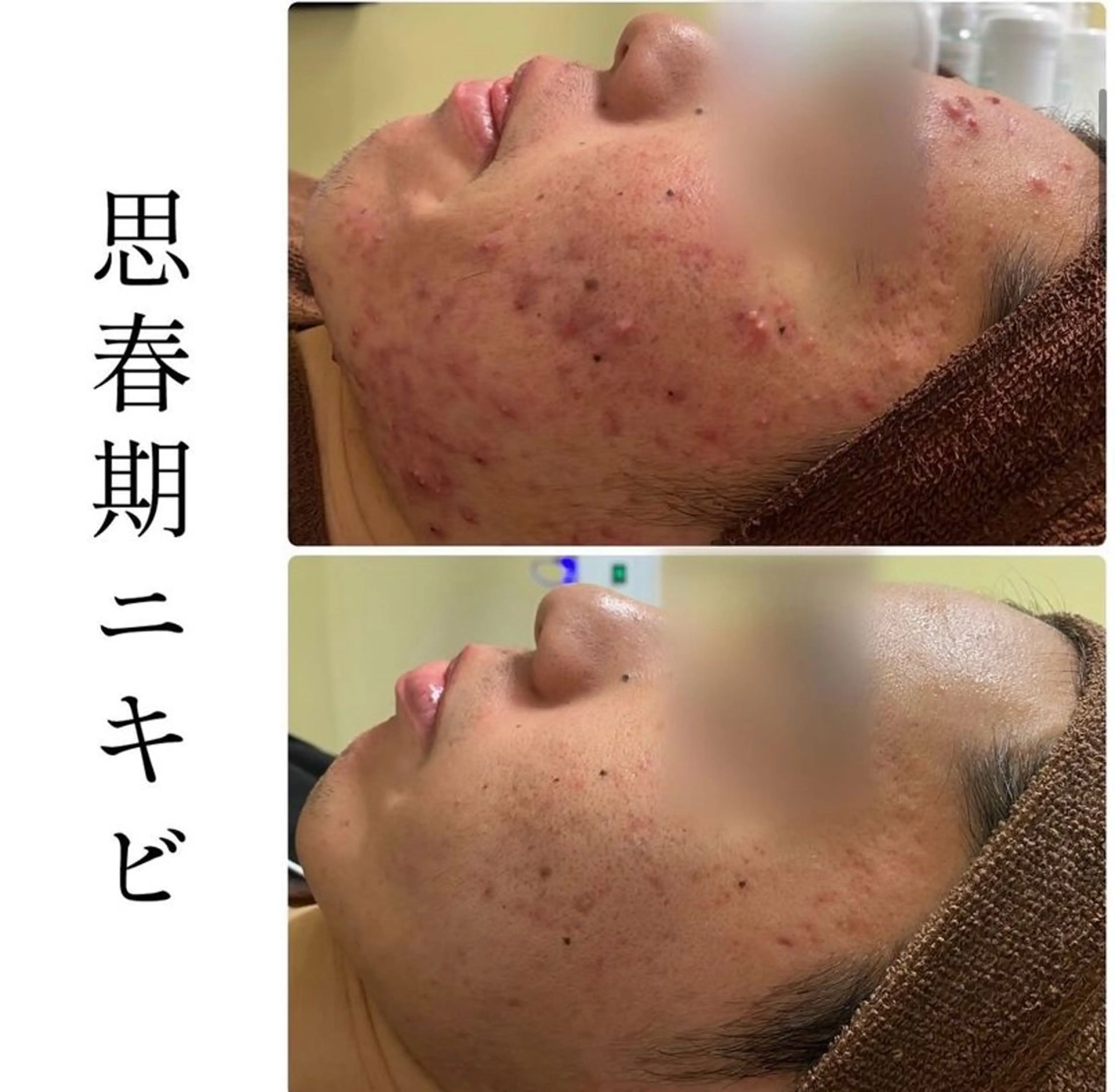 エステ ハーブピーリング専門 BIOPLUS＋川崎のエステ・リラクイメージ