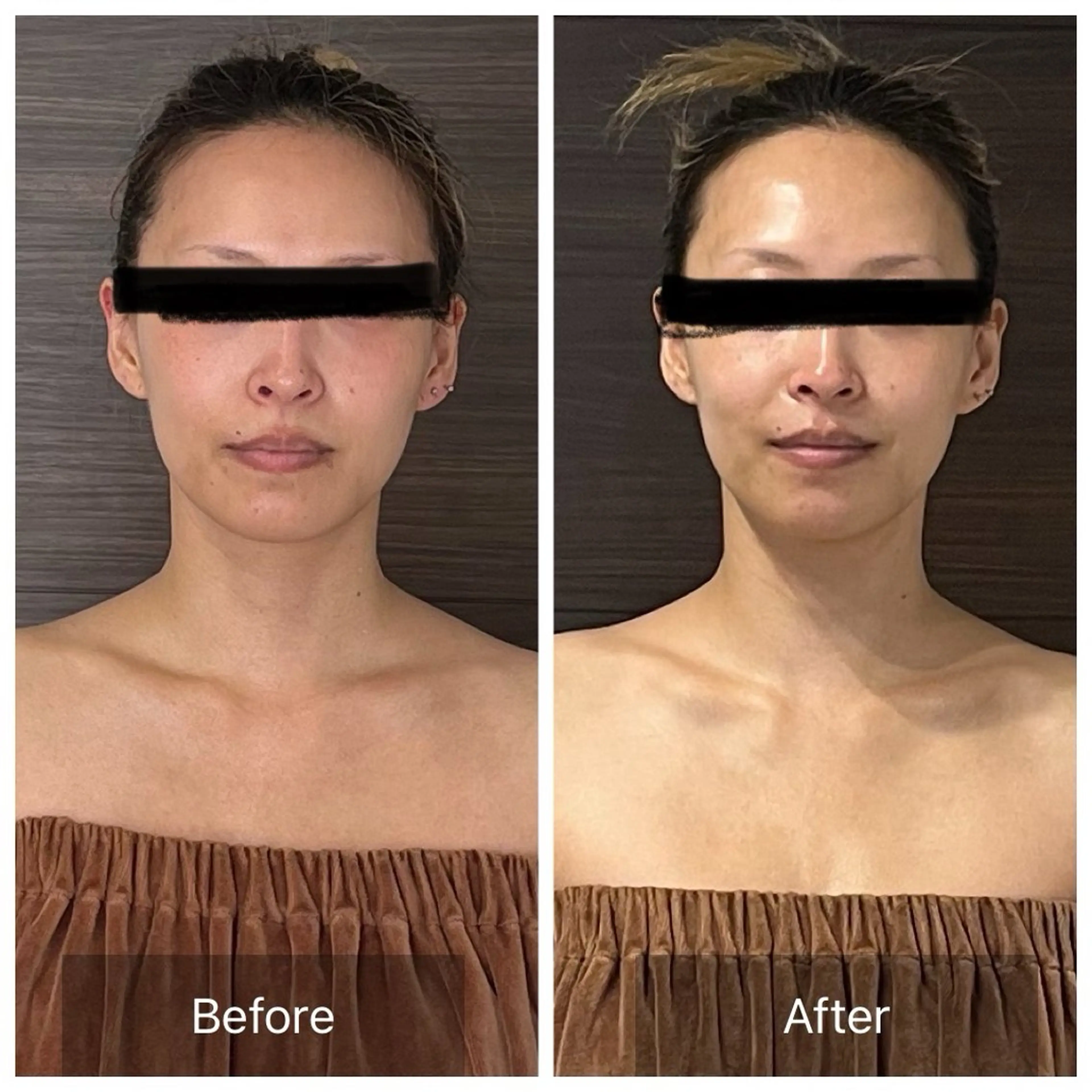 エステ リラク PARAFUSE. MEIのエステ・リラクイメージ