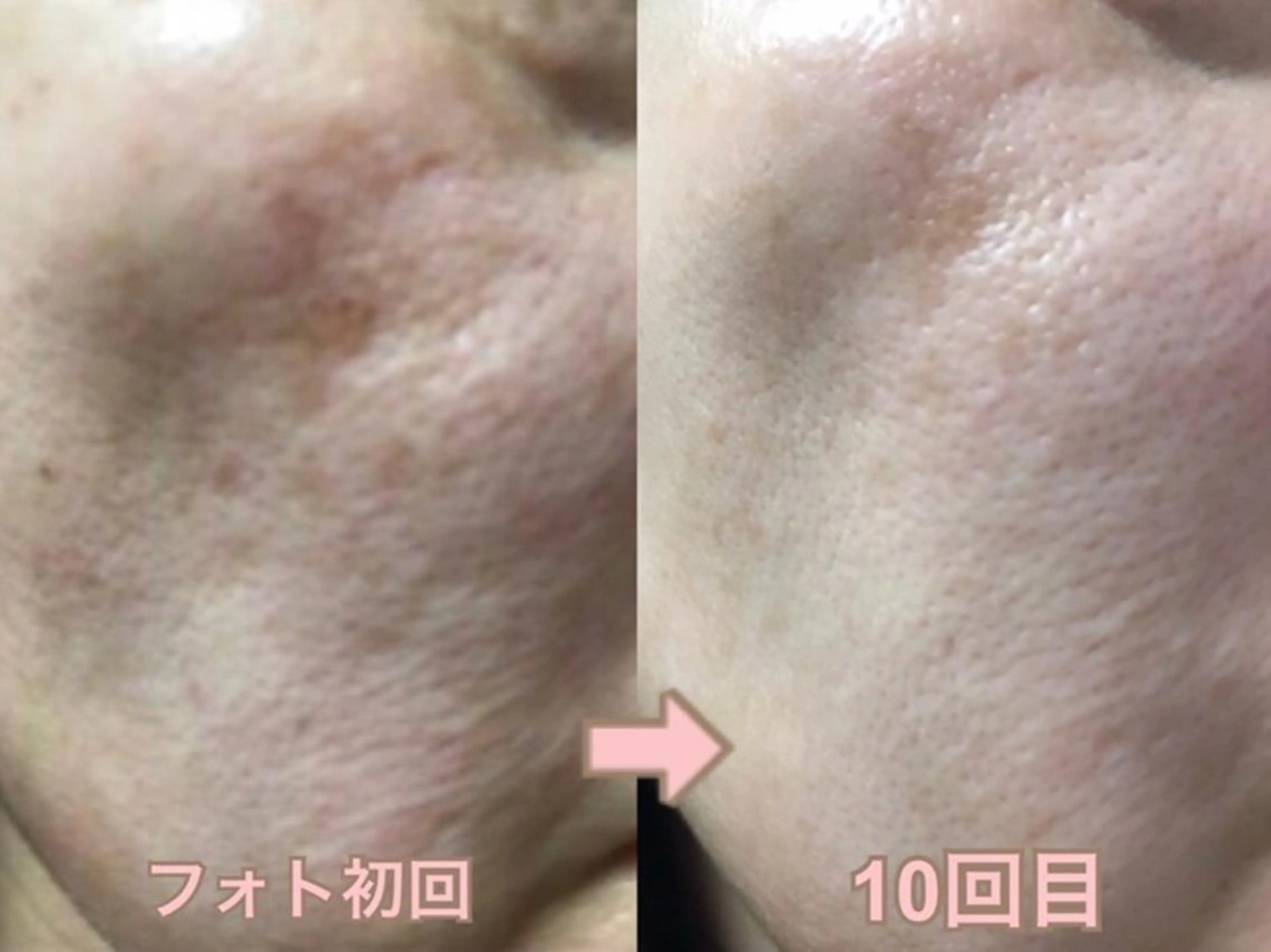 肌ケア＆毛穴洗浄 Cheri/女性専用のエステ・リラクイメージ