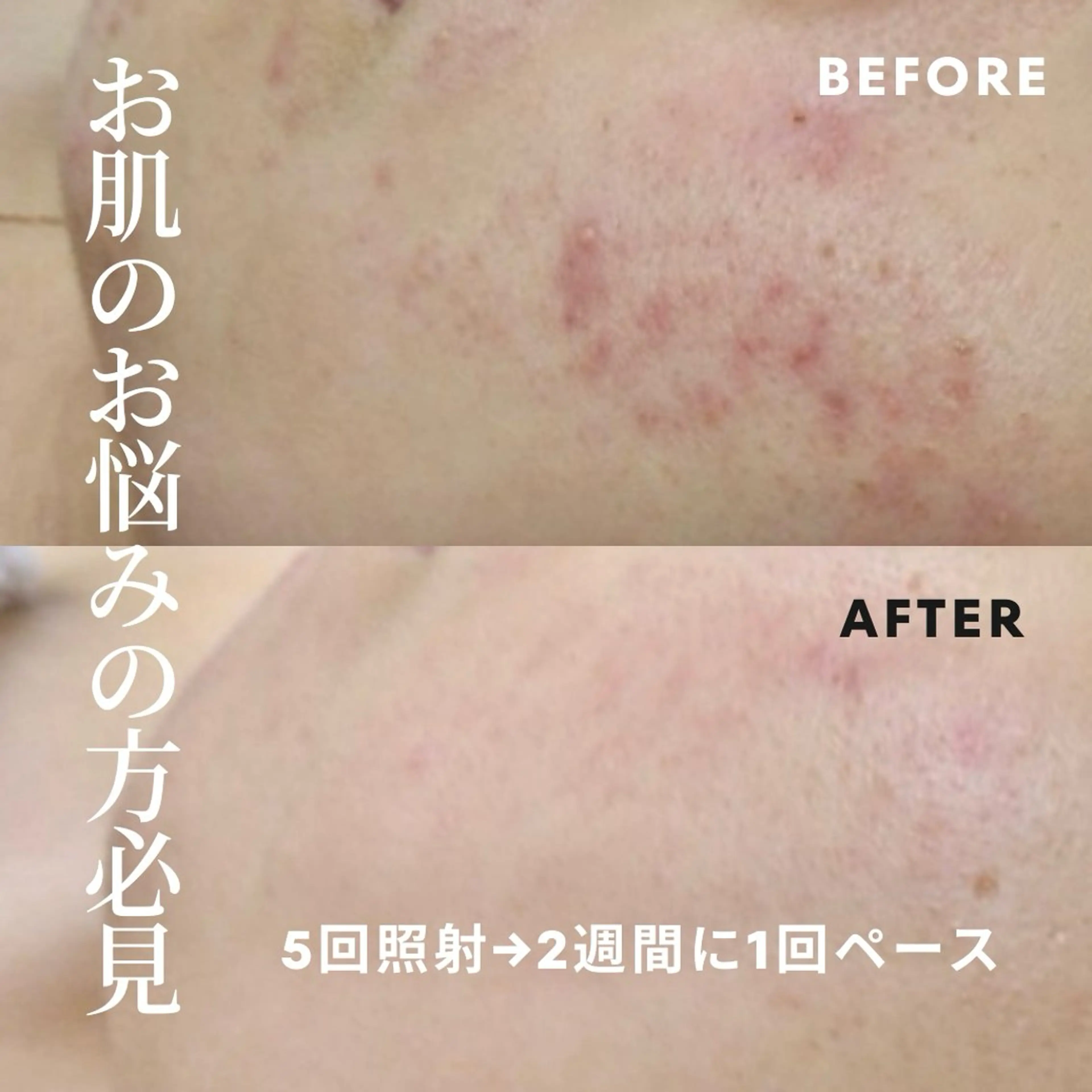 メンズ 脱毛しま専科 宗右衛門町店のエステ・リラクイメージ