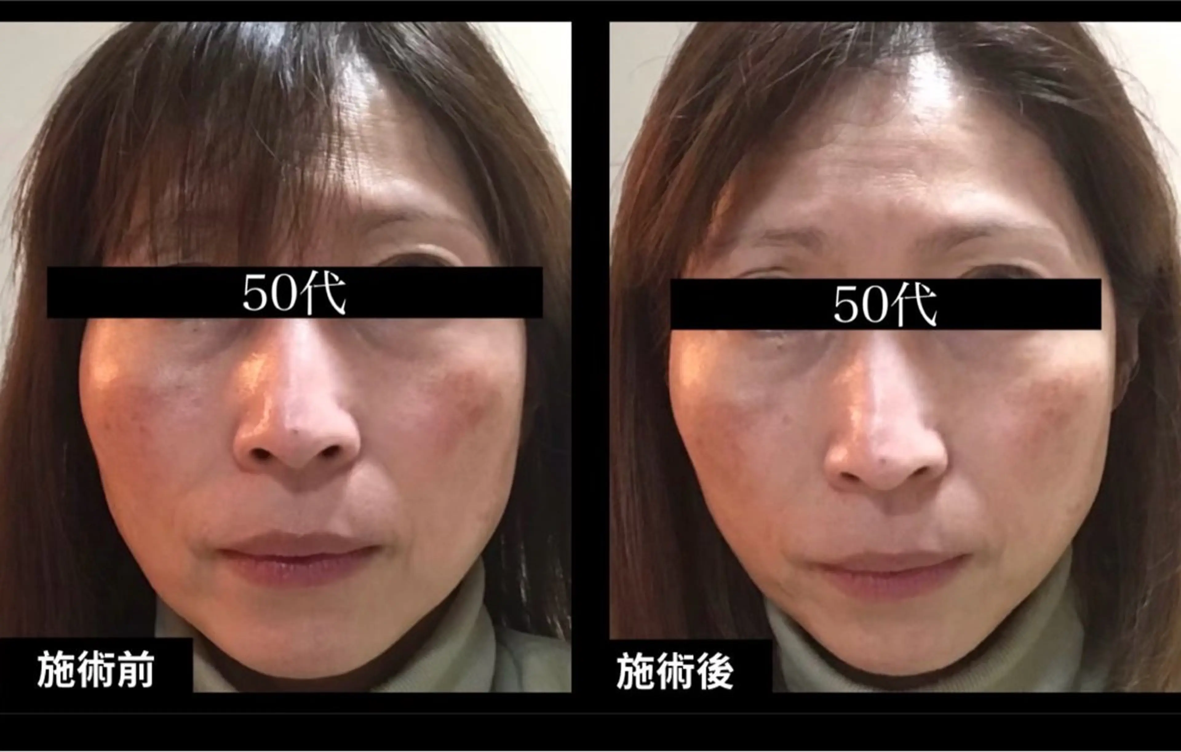 エステ リラク 夜サロン♡ Luana🦋.*˚のエステ・リラクイメージ