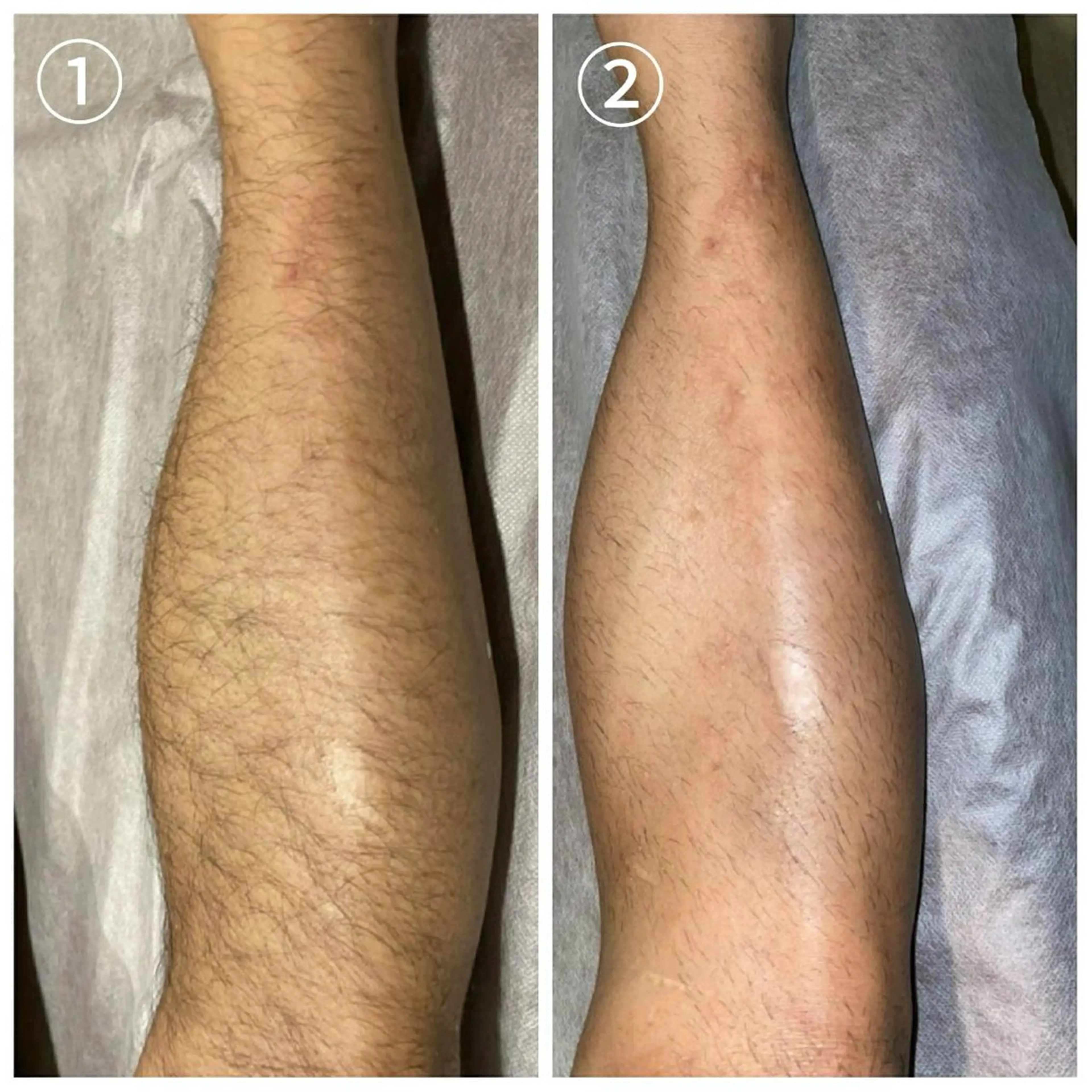 メンズ 脱毛 脱毛サロン　セラヴィ 吉祥寺 KEITAのエステ・リラクイメージ