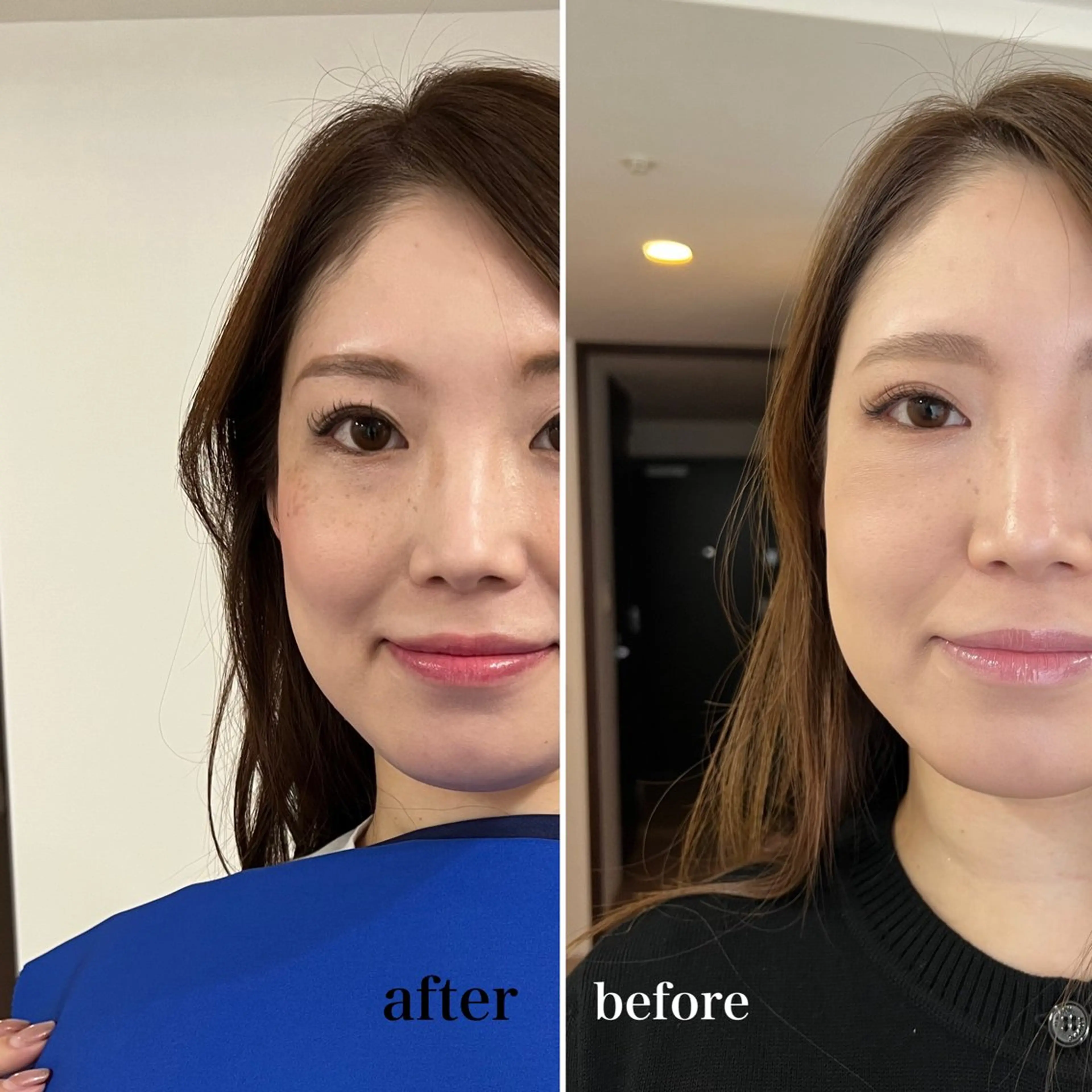 ミディアム カラー ヘアアレンジ パーソナルカラー診断 骨格診断 顔タイプ診断 北新地堂島人気店 ラ・ヴェリーテのエステ・リラクイメージ