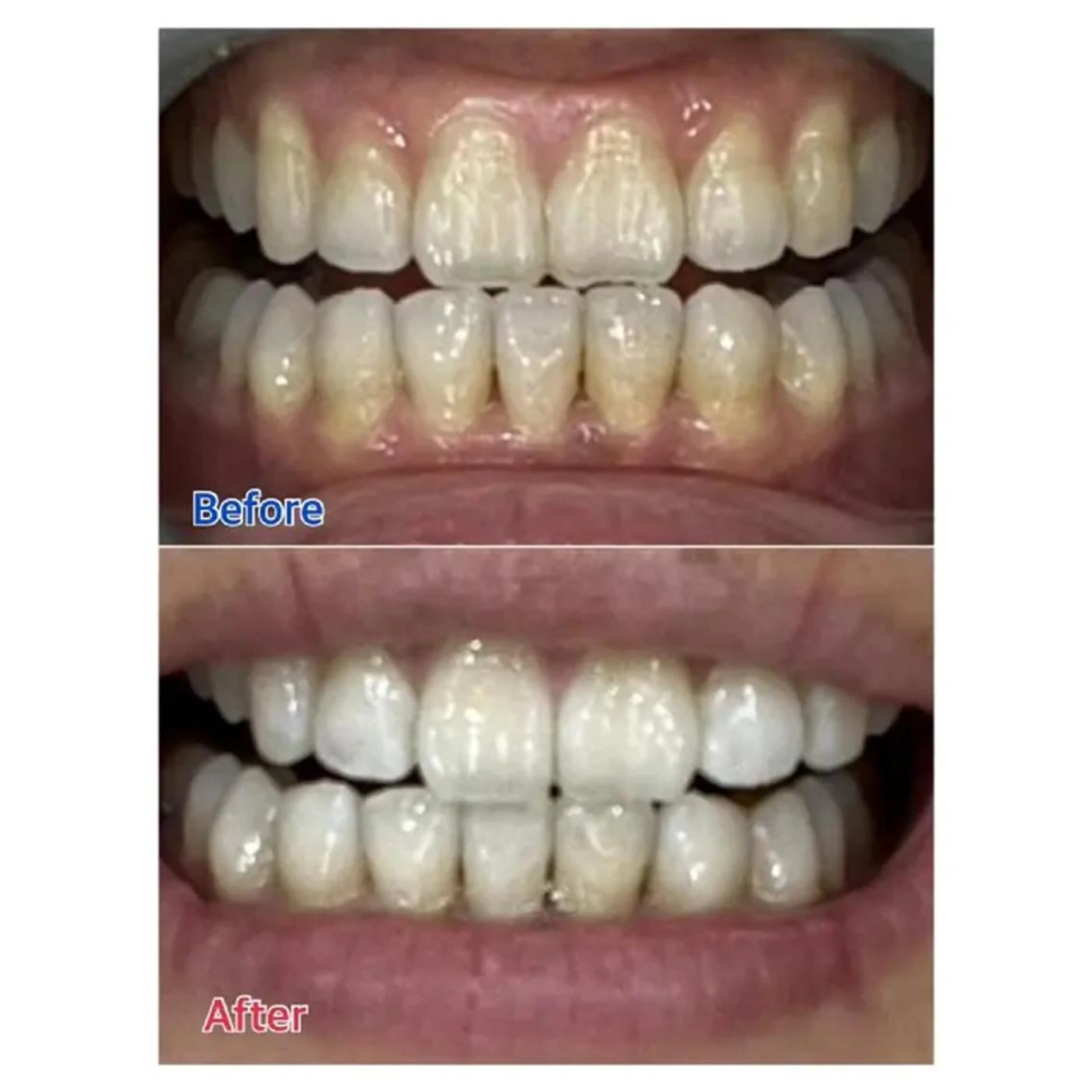 M渋谷 ホワイトニングのエステ・リラクイメージ