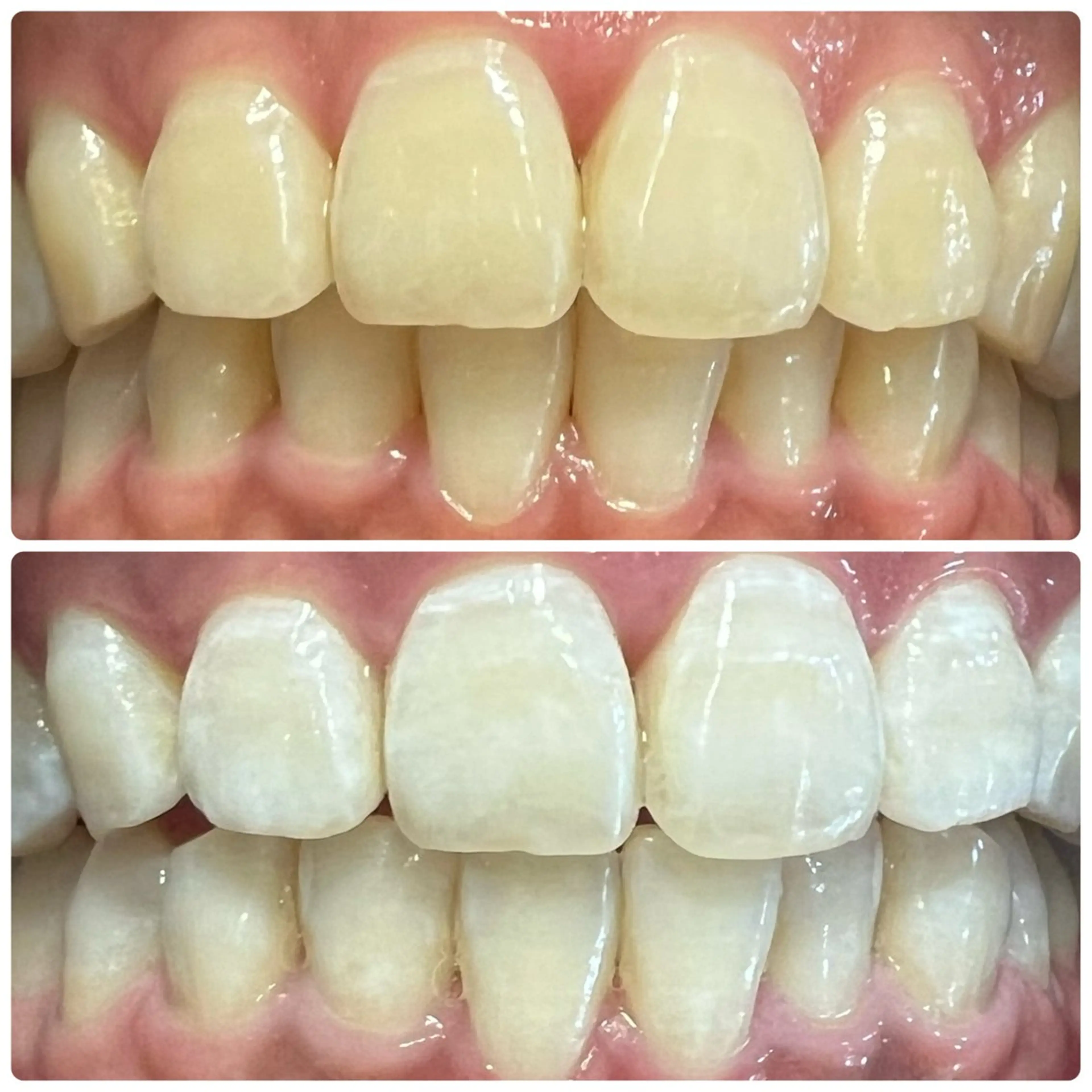 エステ ホワイトニングルーム 横浜店のその他イメージ