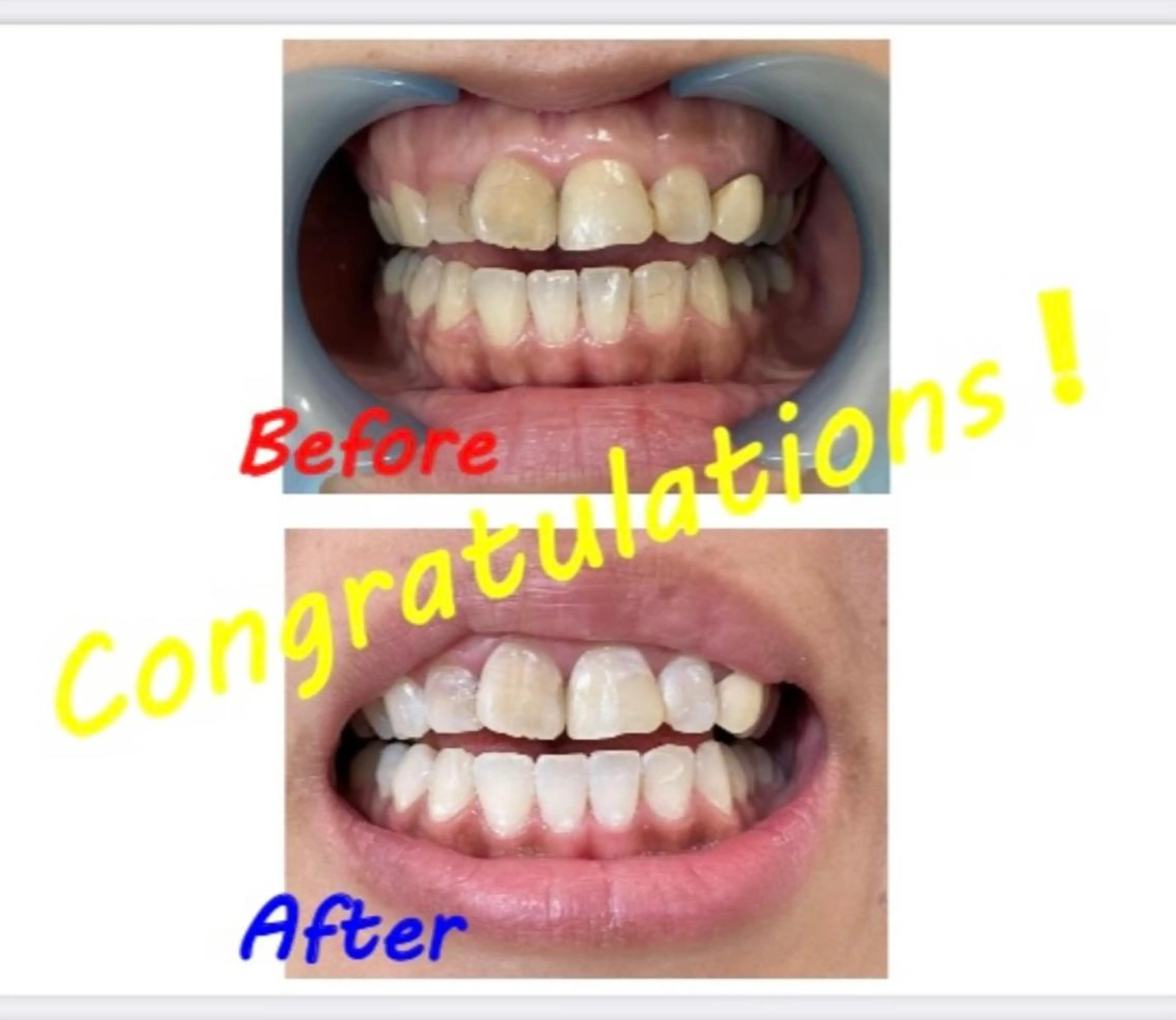 その他 セルフホワイトニングサロン　ラヴィアン所属・ホワイトニングサロン La vie enのその他イメージ